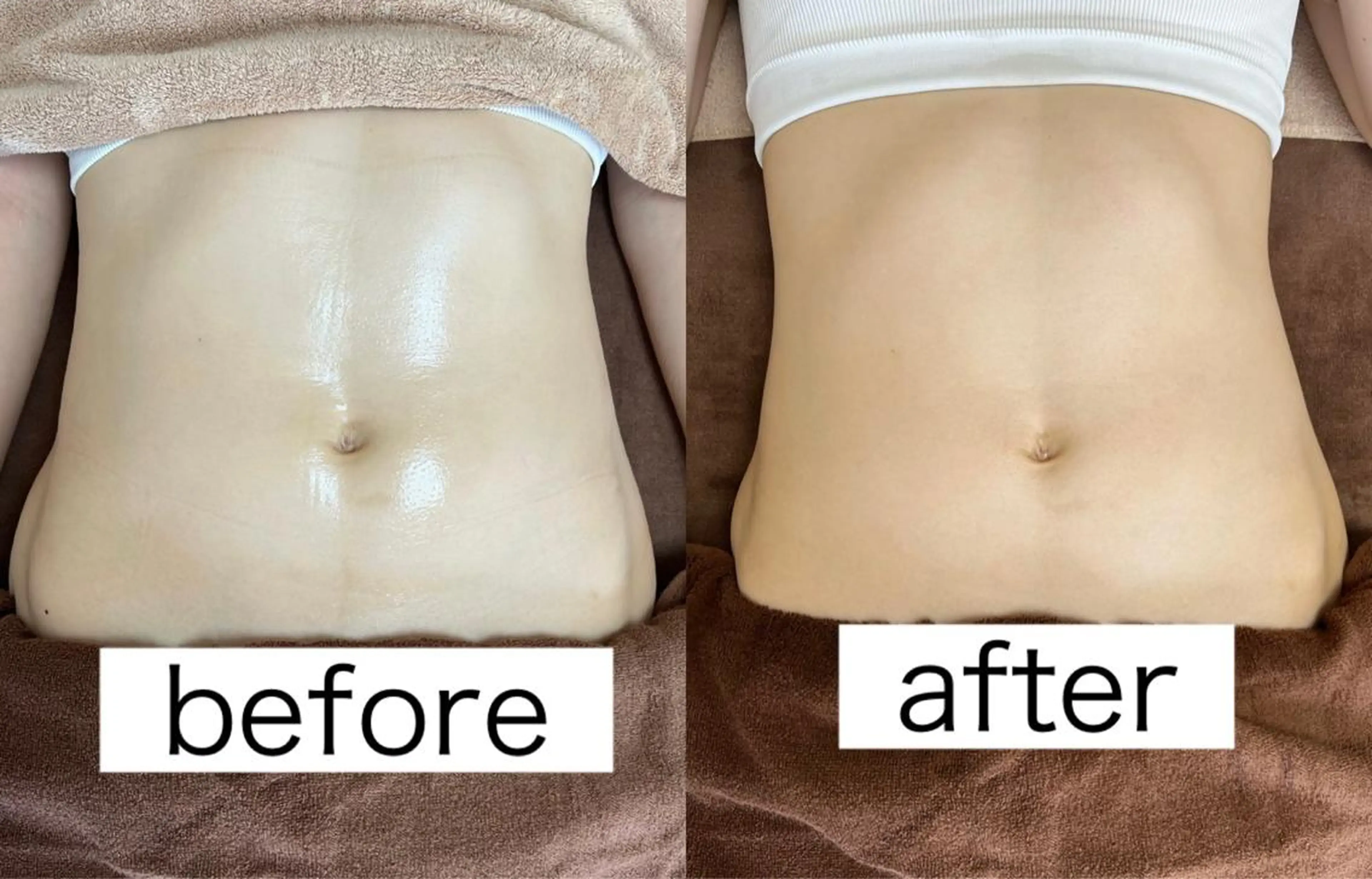 Beauty   Salon  Adiy所属・Adiy ikumiのエステ・リラクイメージ