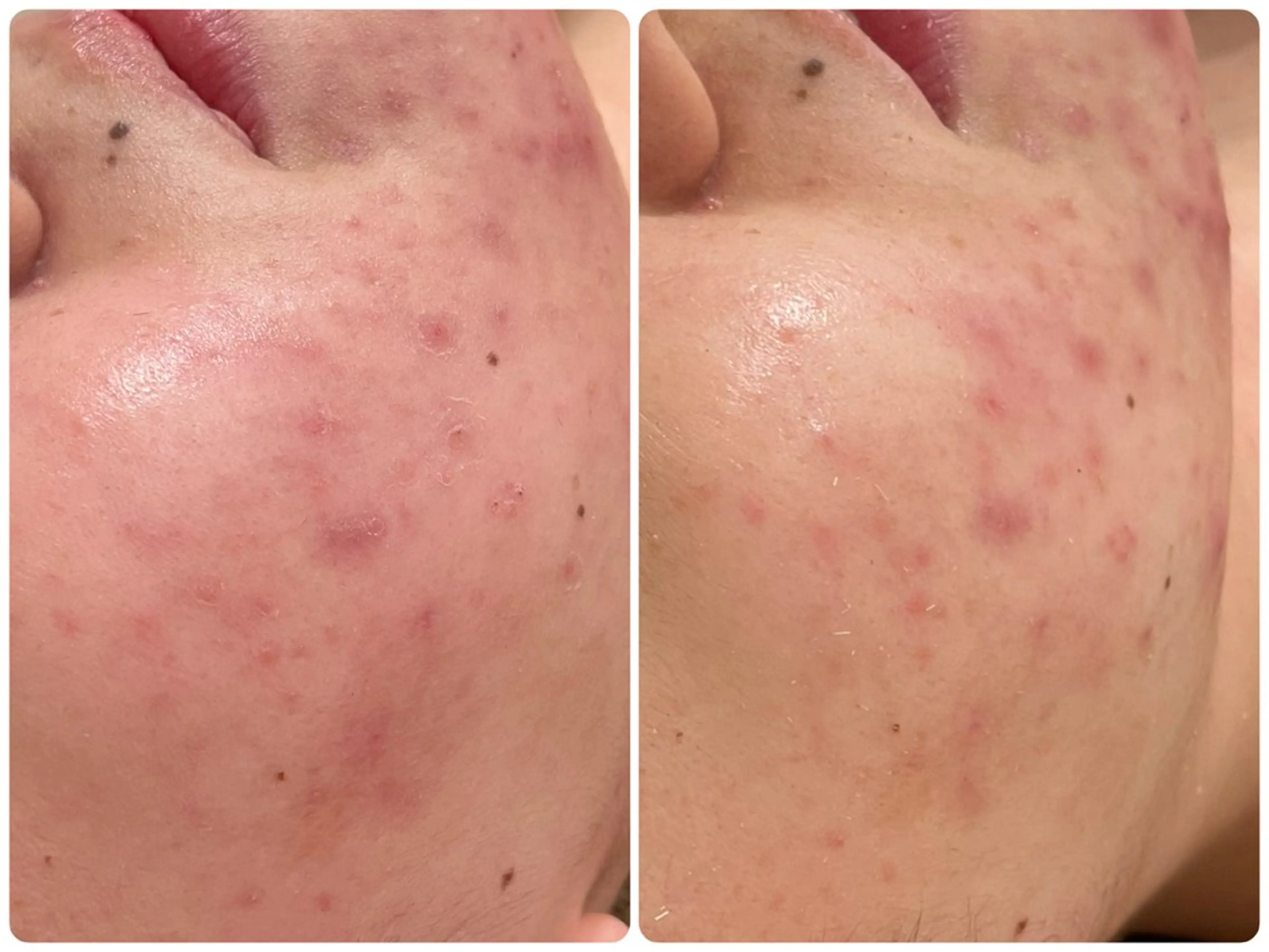 イデアルMe♡ NAKAMURAのその他イメージ