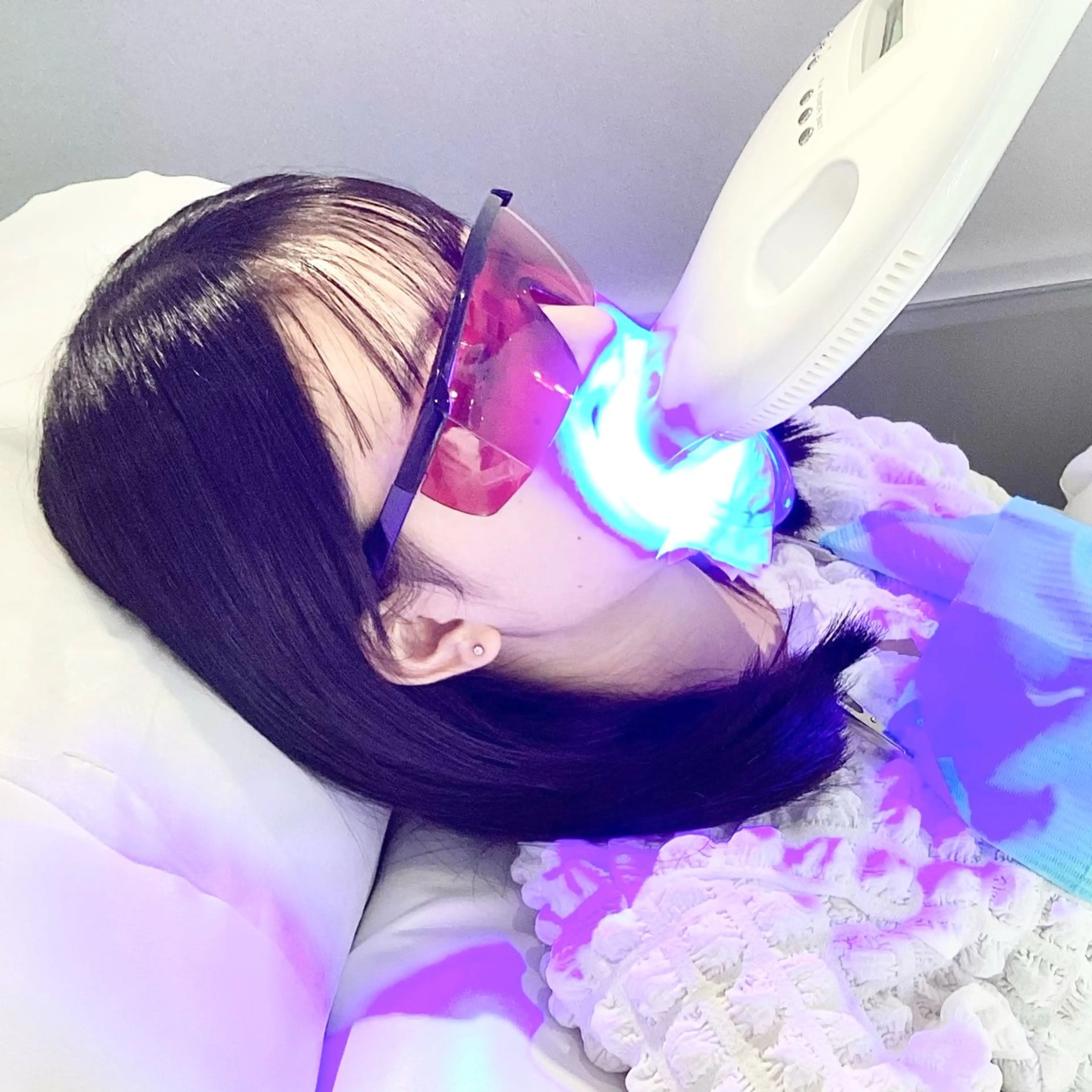 ホワイトニングテラス ティンクルのその他イメージ