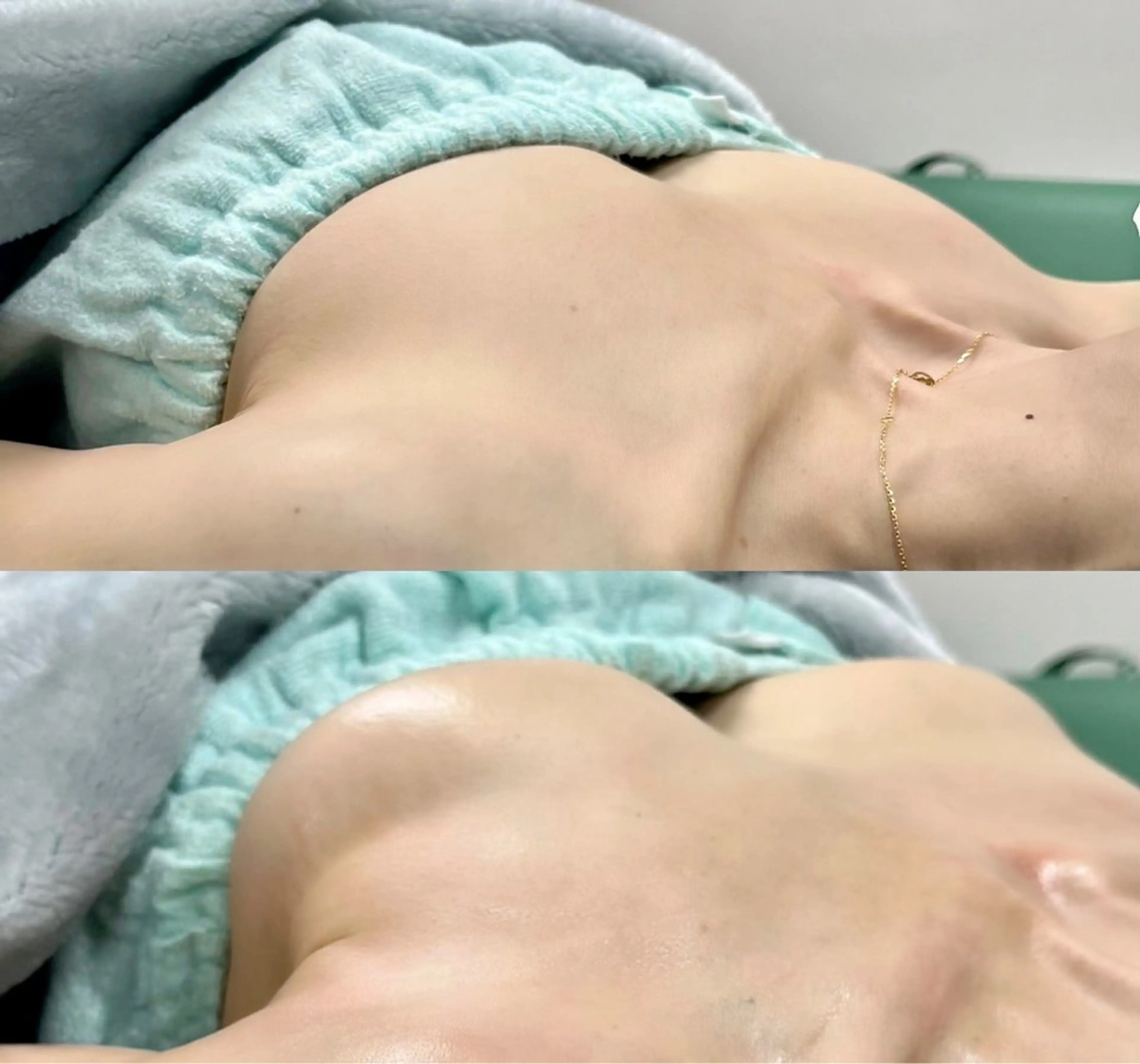 エステ エスボニータ所属・加藤 美香のエステ・リラクイメージ