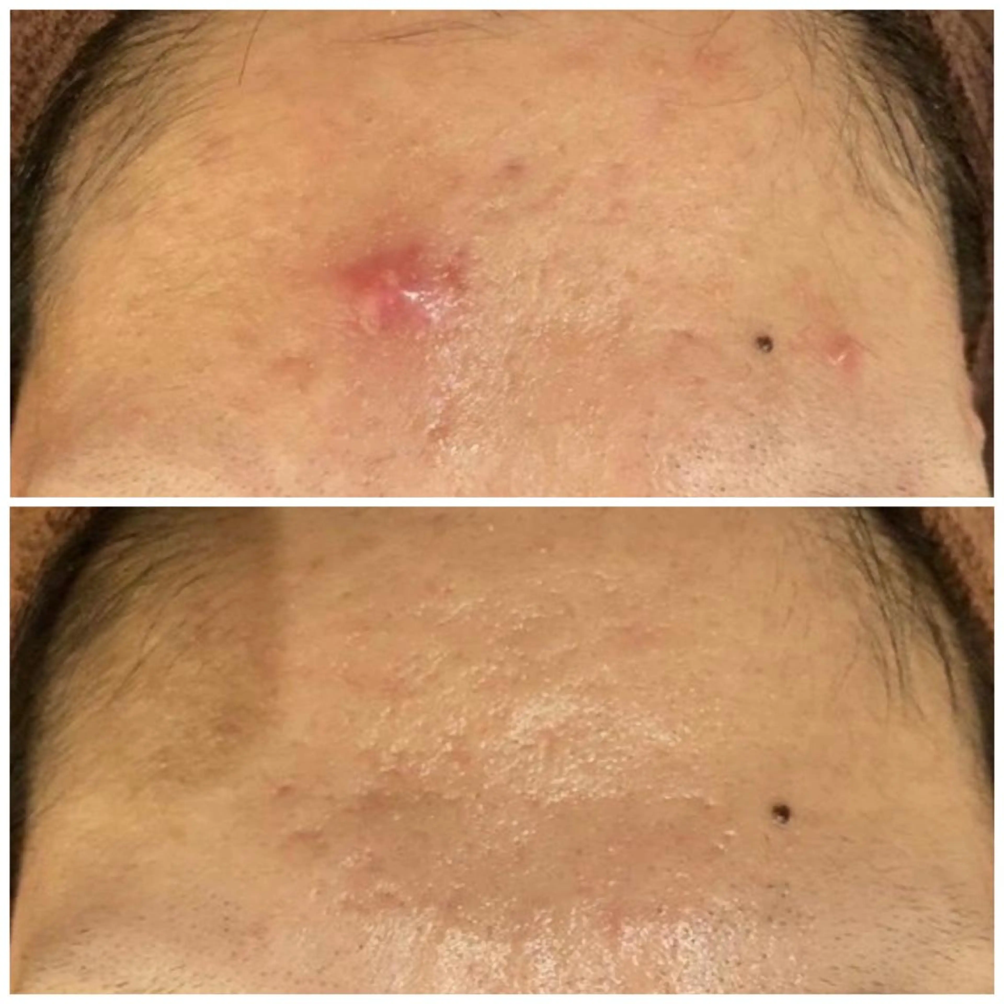 触れたくなる モテ肌へ...❤︎のエステ・リラクイメージ