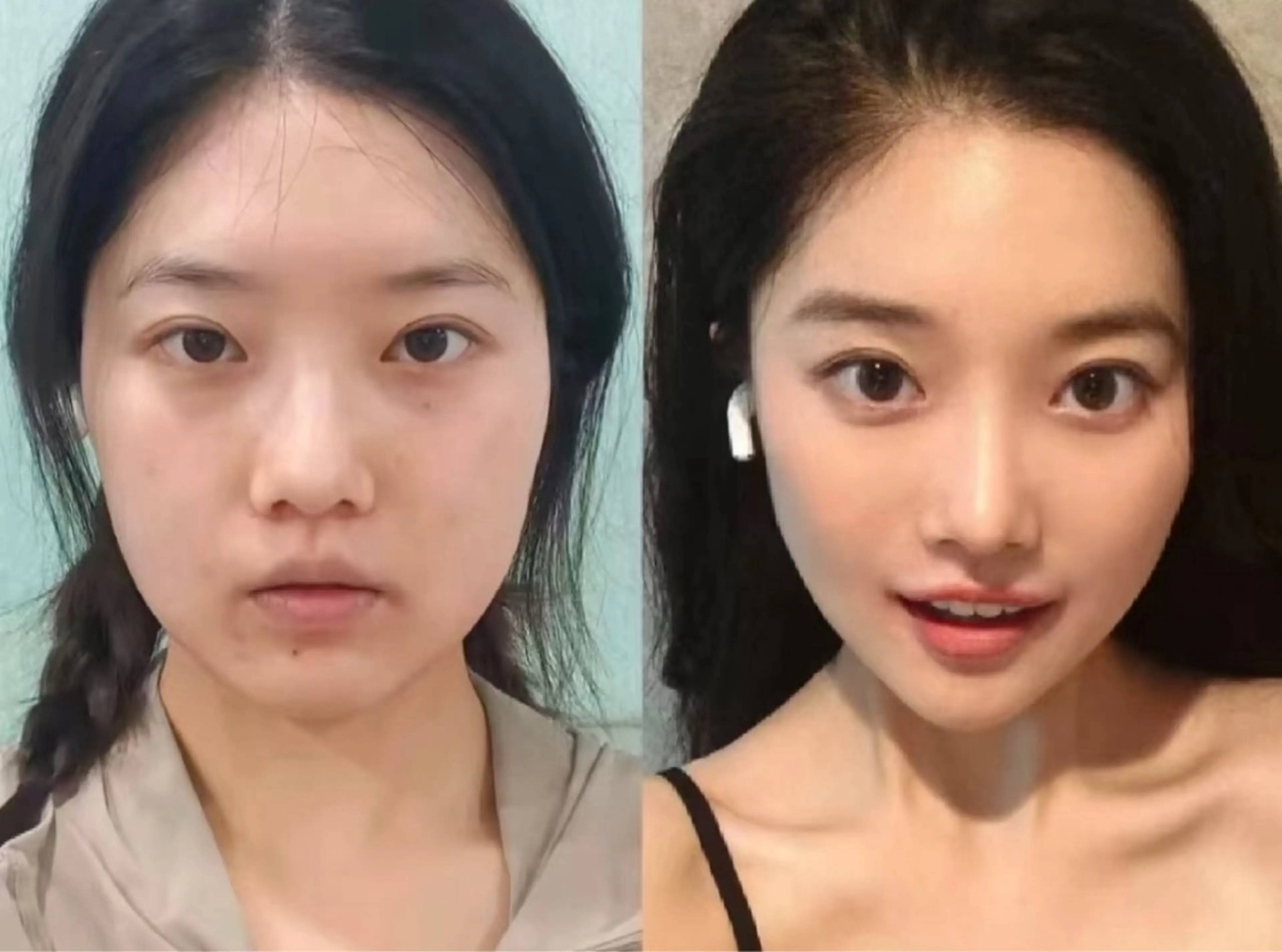 ネイル エステ aliaハイフ&水光ジェットサロン所属・aliaハーブ水光店 エステティシャン募集のエステ・リラクイメージ