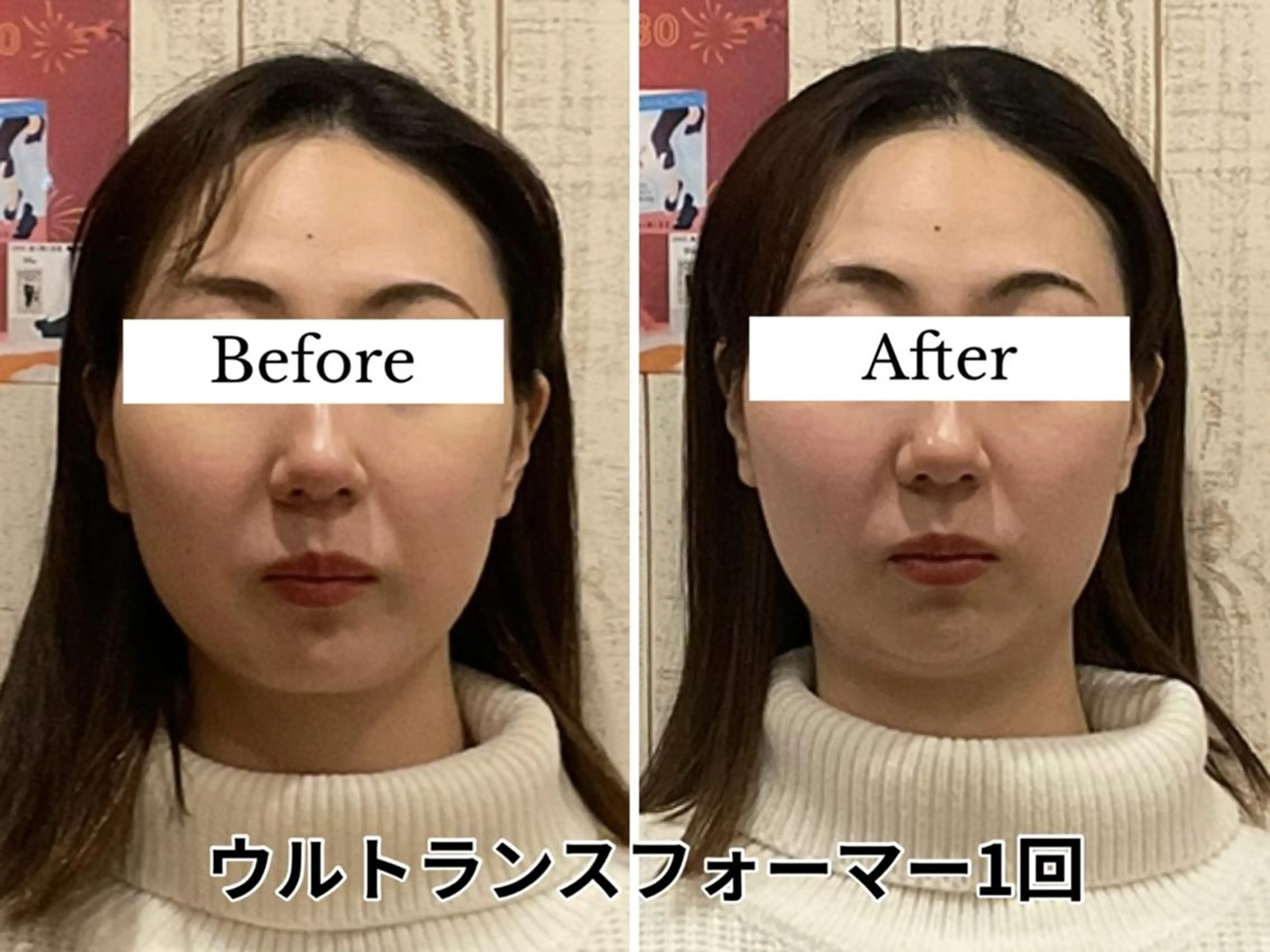 小顔矯正 natsuのエステ・リラクイメージ