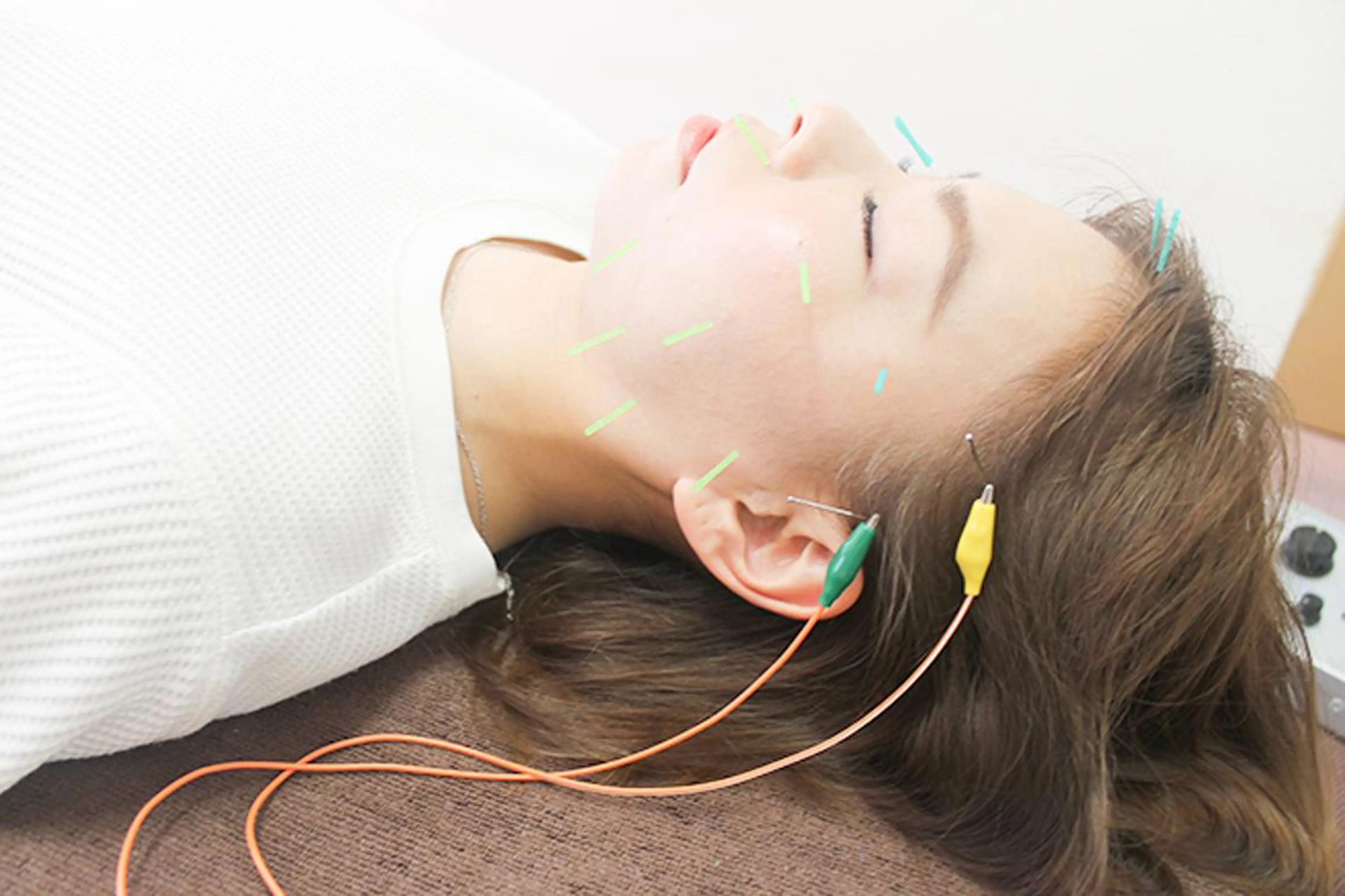 エステ 同心整骨院 美容鍼・整体・小顔のエステ・リラクイメージ