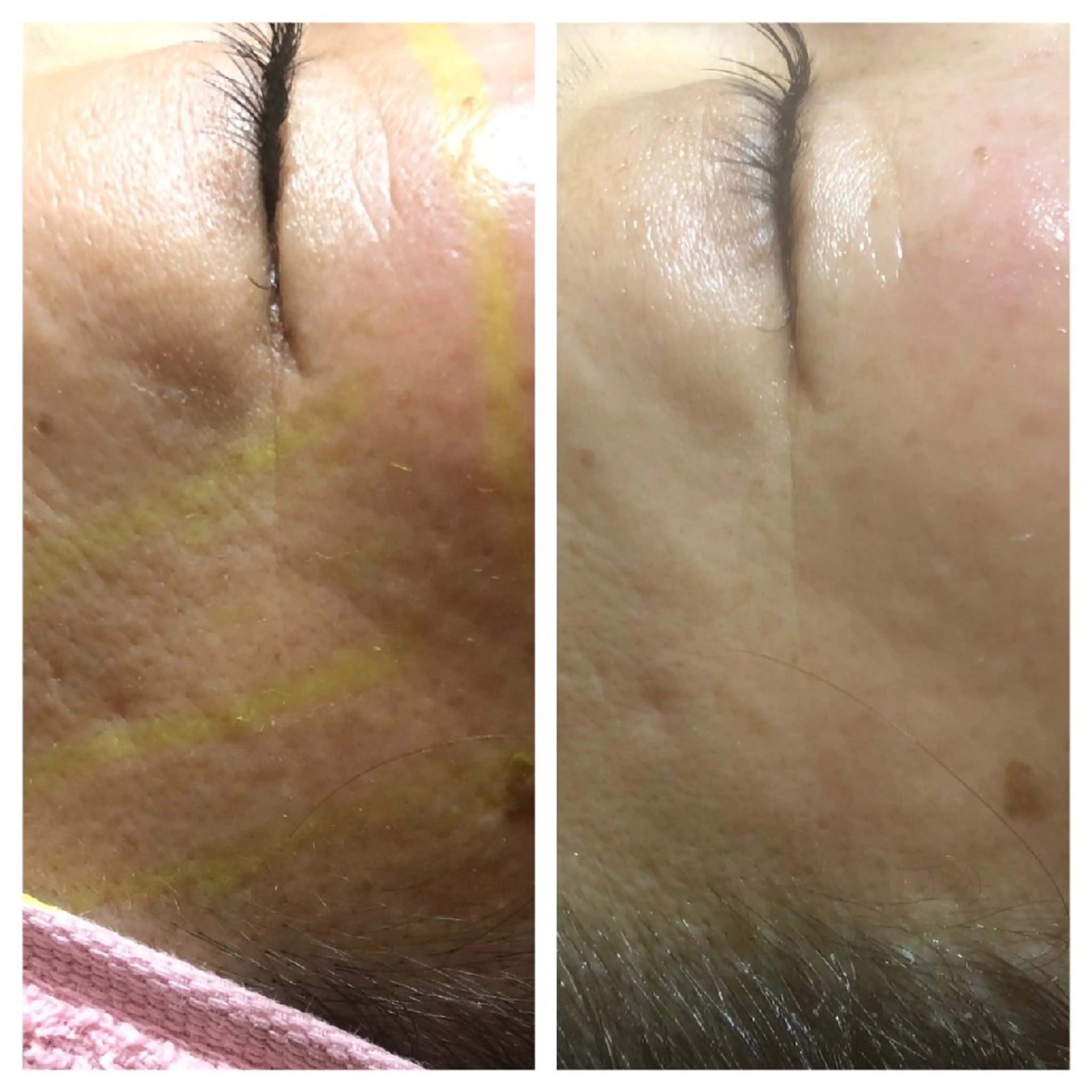 越谷小顔痩身サロン南国‐蒼‐ao所属・南国‐蒼あお‐ ビューティーサロンのその他イメージ