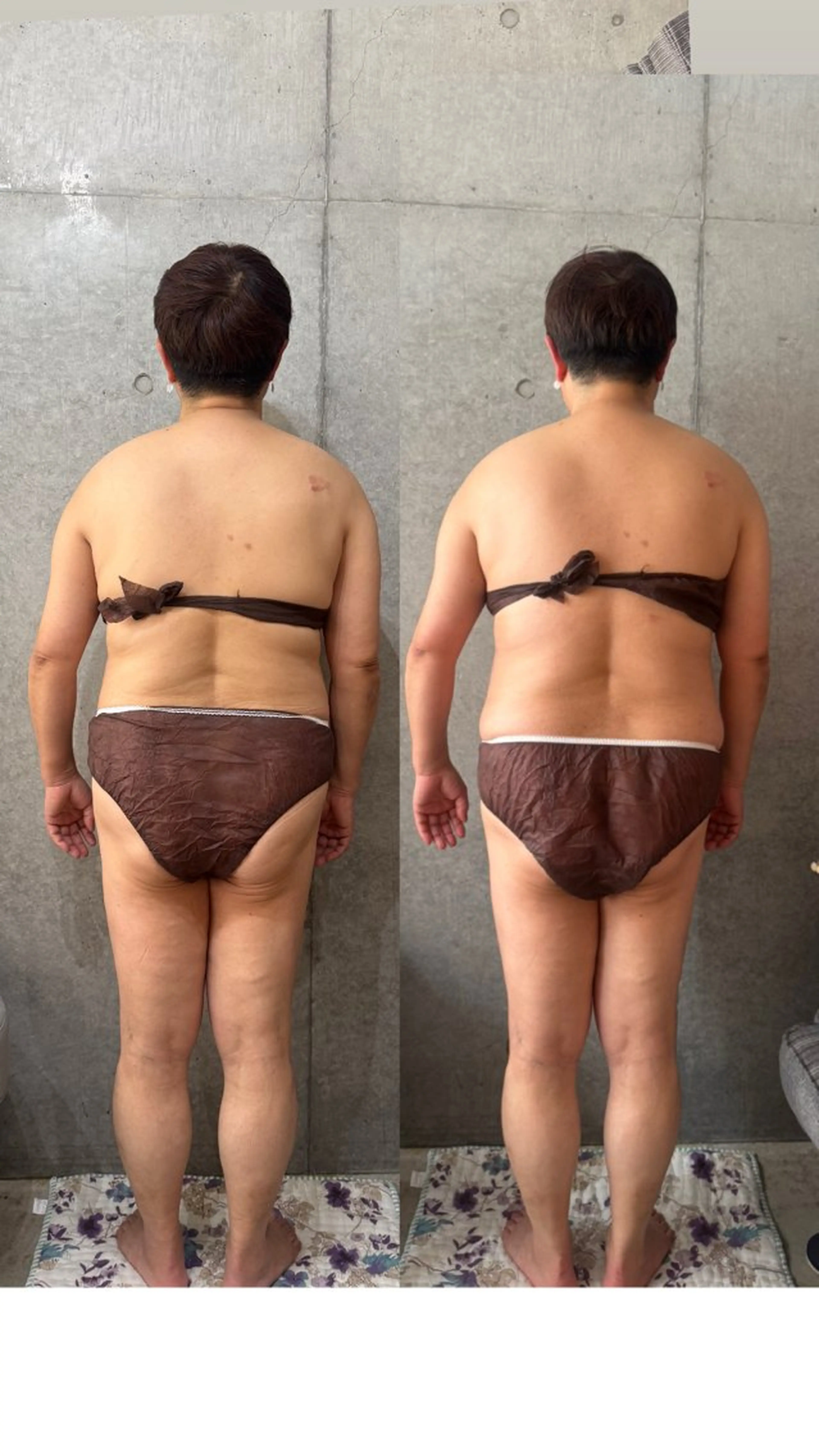 Crystallo Sana N所属・痩身・リンパ 佐久間 自由が丘・奥沢のエステ・リラクイメージ