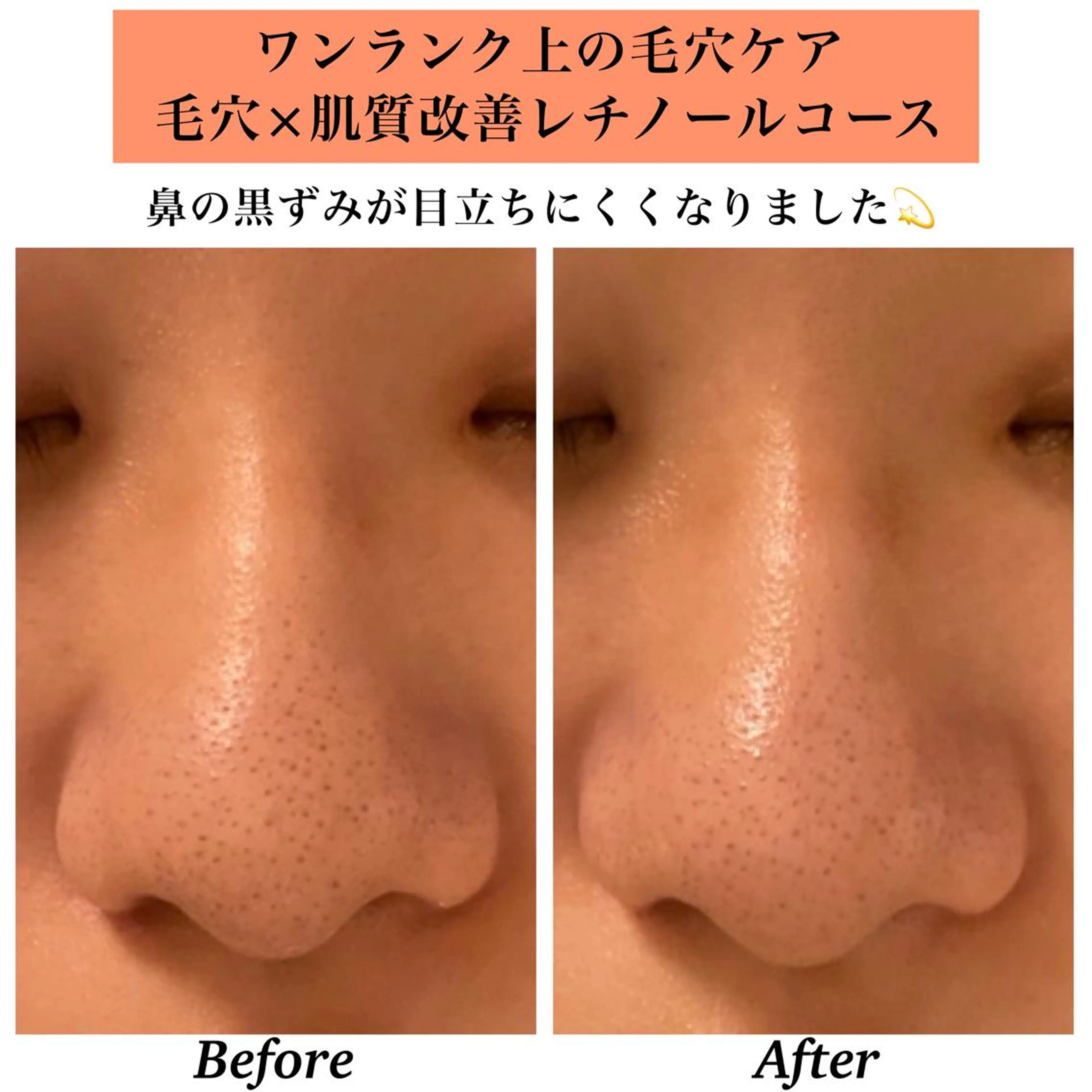 エステ リラク Bellesthe （ベルエステ）のエステ・リラクイメージ