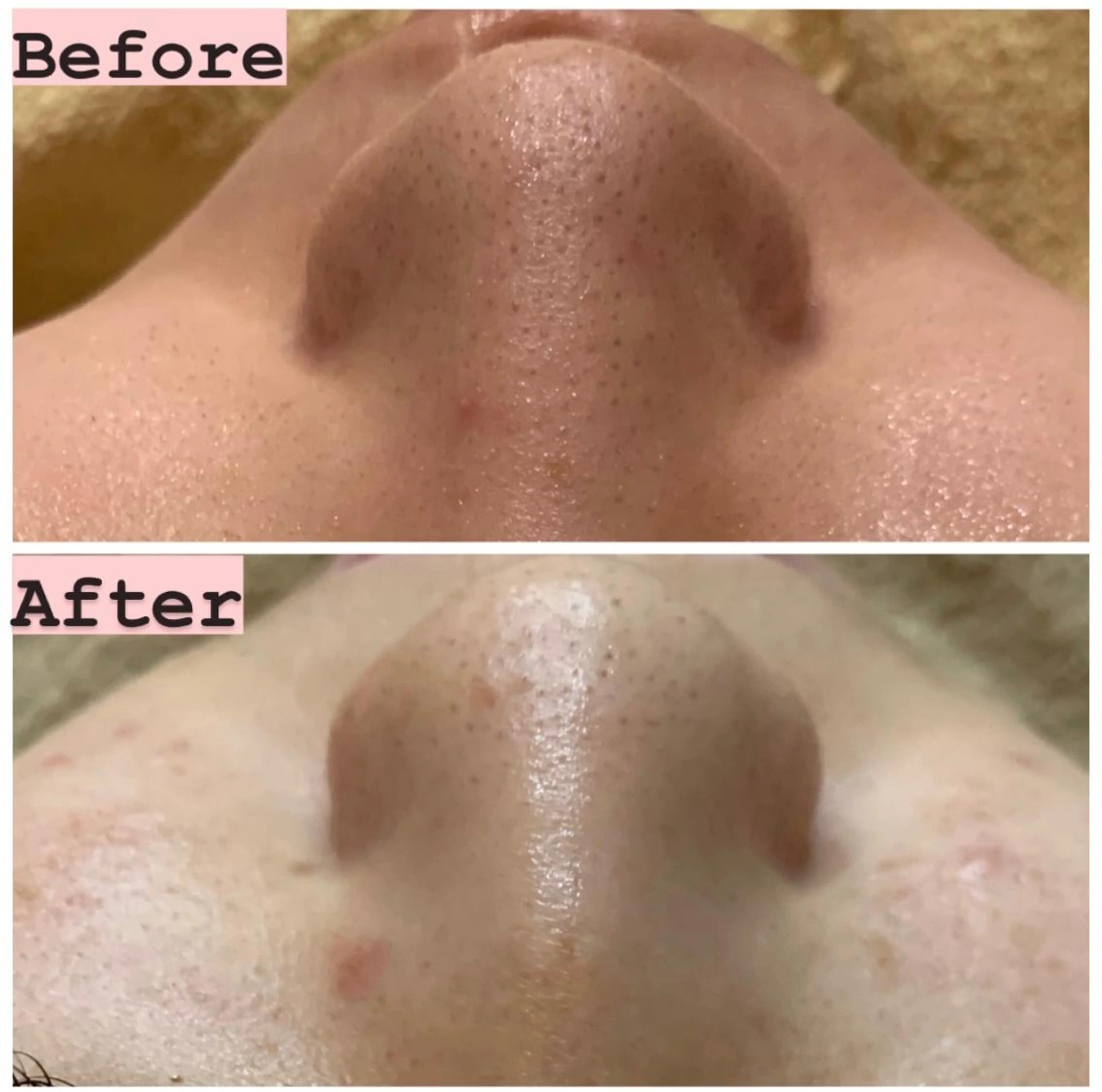 ハーブピーリング専門 muro.のエステ・リラクイメージ