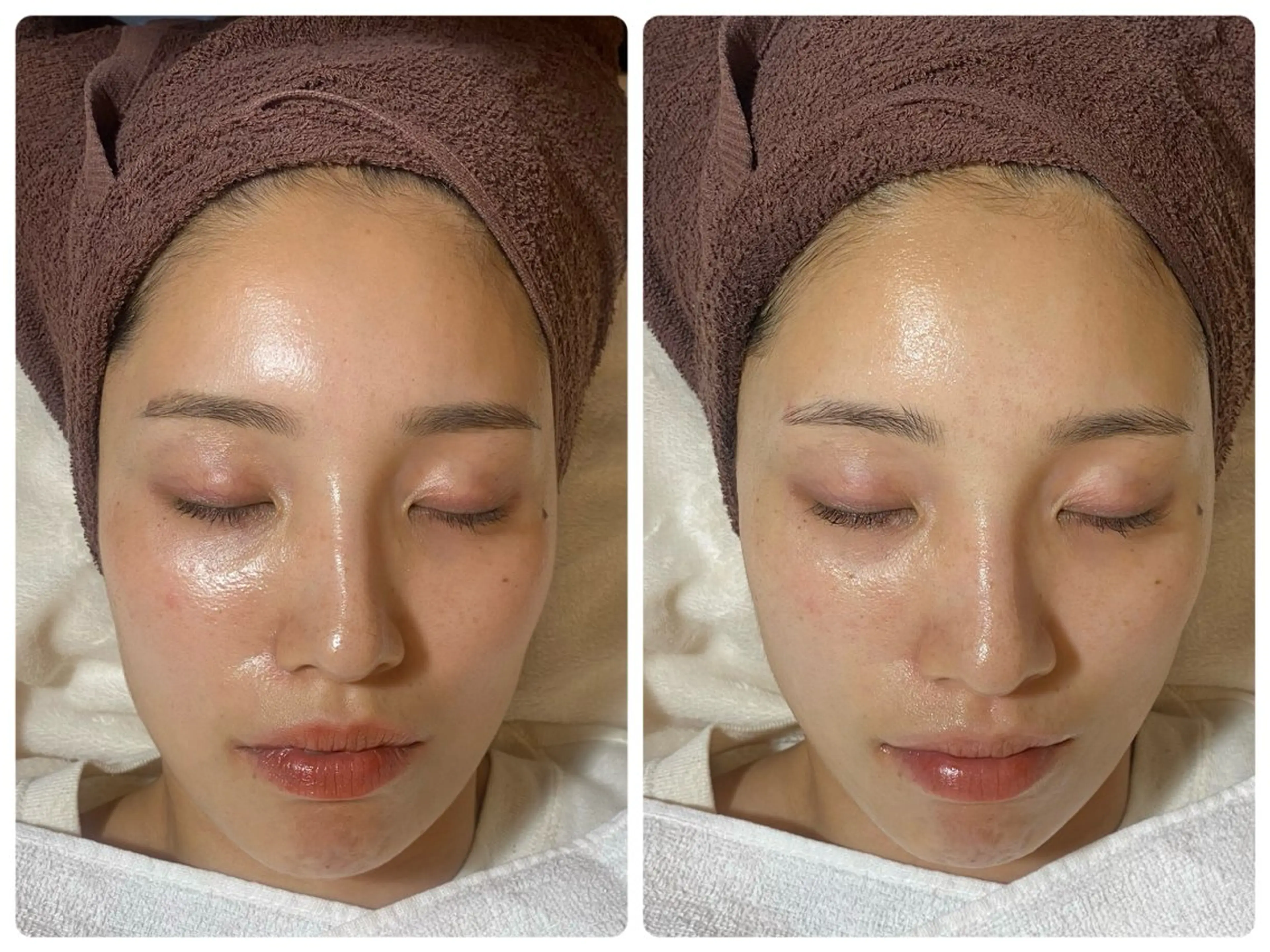 ｃｉｃｅｒ　よもぎ蒸し・ハーブピーリング所属・cicer🌿 Naomi☺︎☺︎のエステ・リラクイメージ