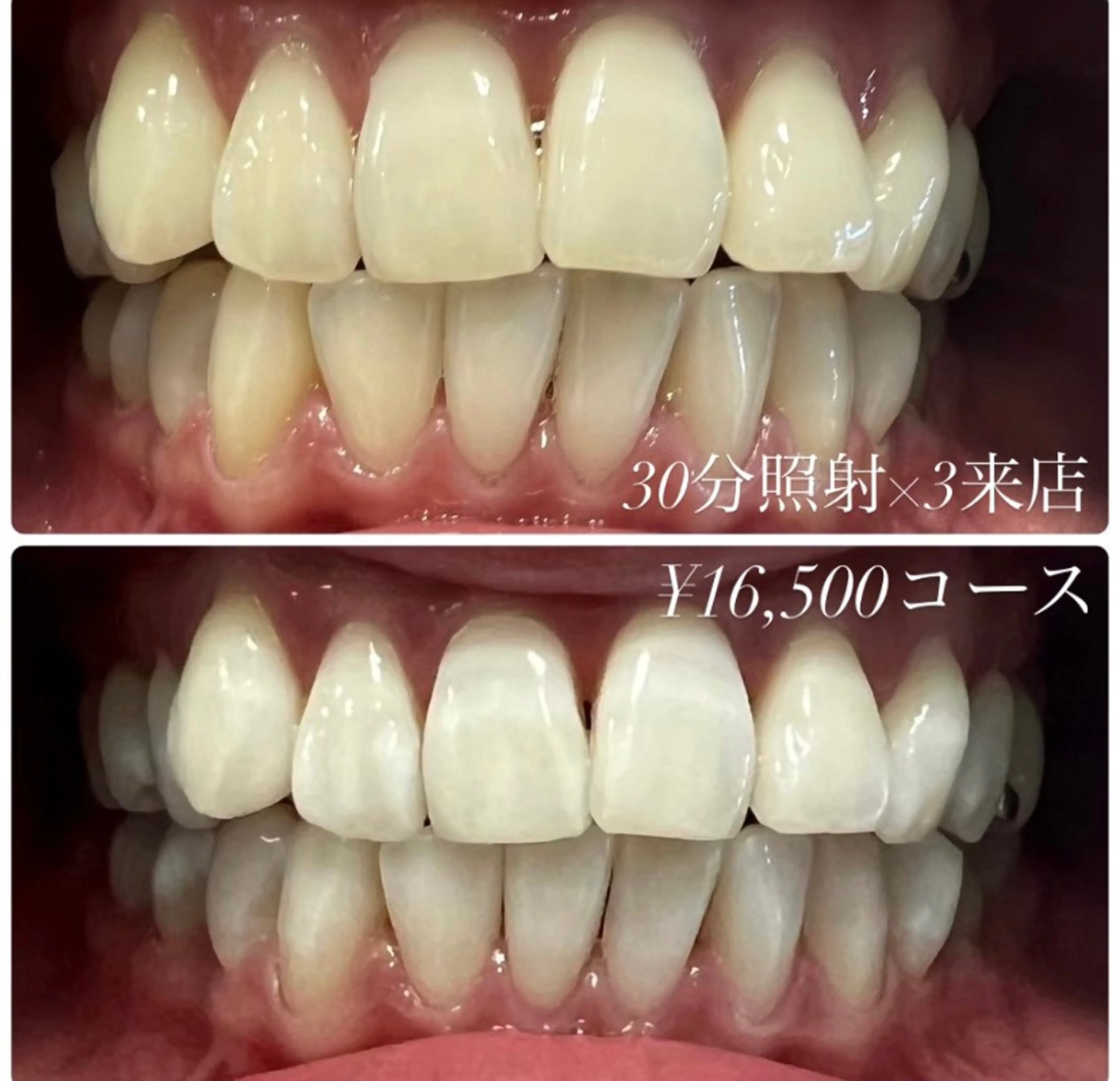 メンズ キッズ その他 ホワイトニングルーム　川崎店所属・ホワイトニング ルーム　川崎店のその他イメージ