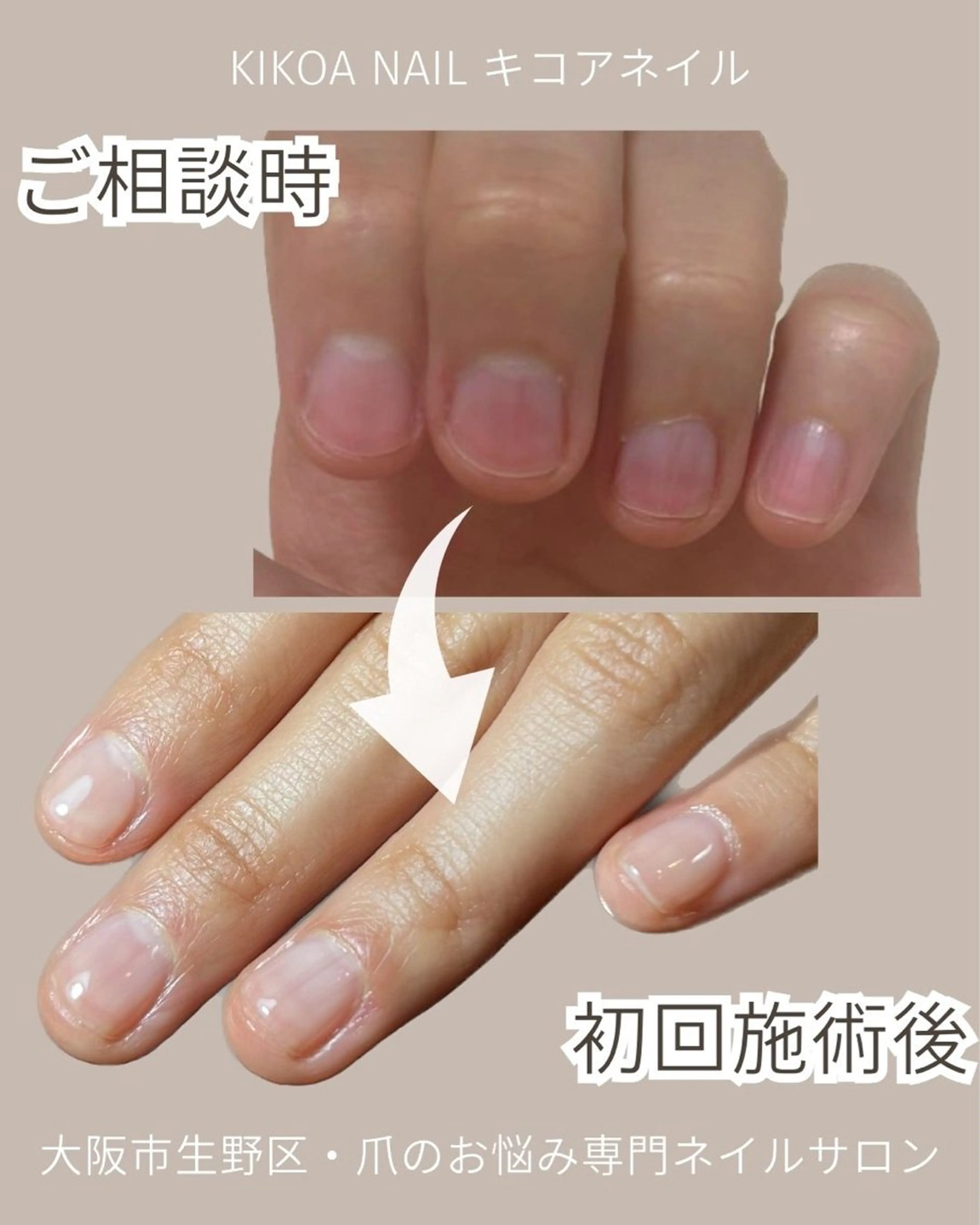 ネイル KIKOA NAIL キコアネイルのネイルデザイン