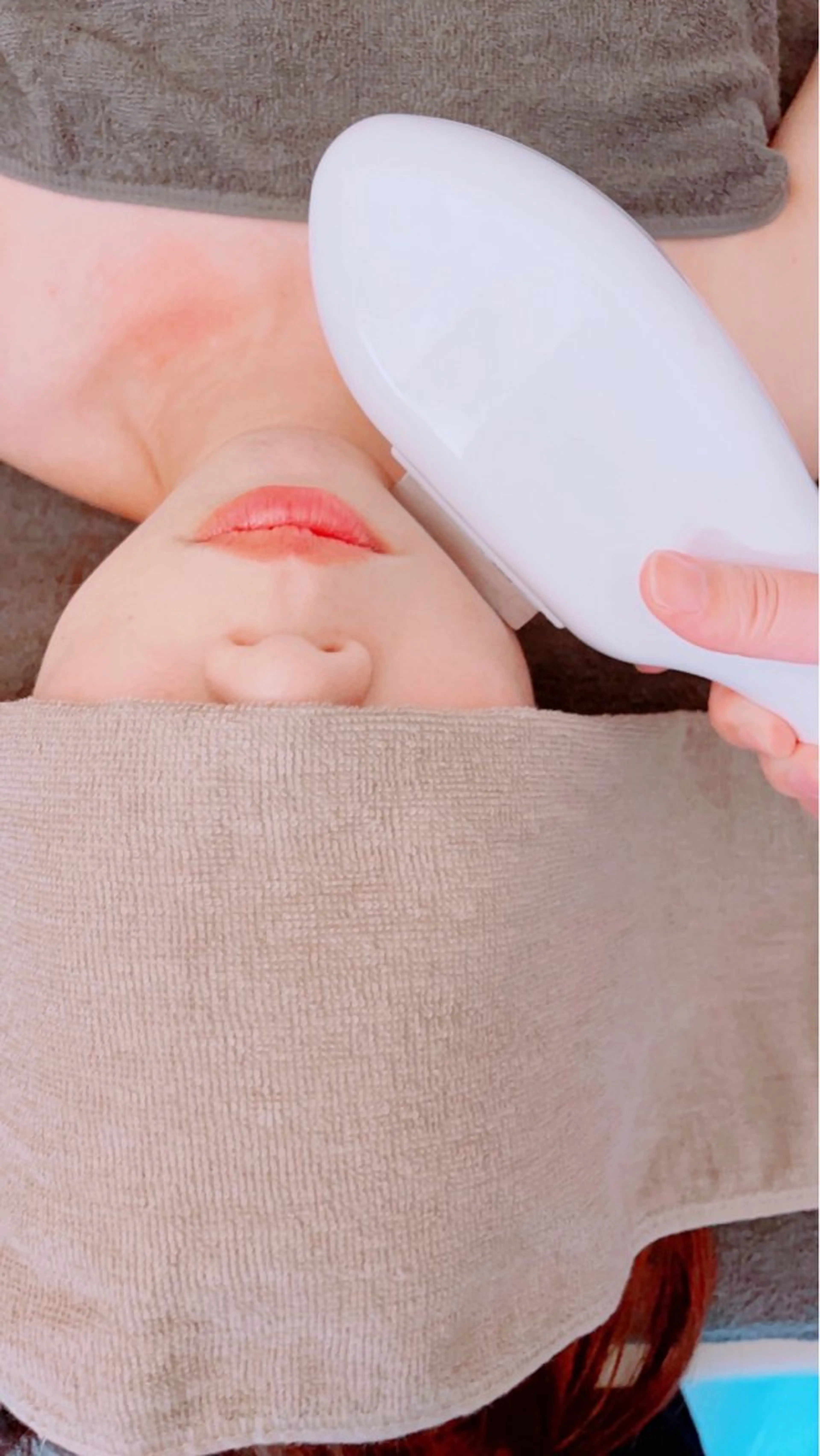 女性☆光脱毛VIO &顔全体の写真