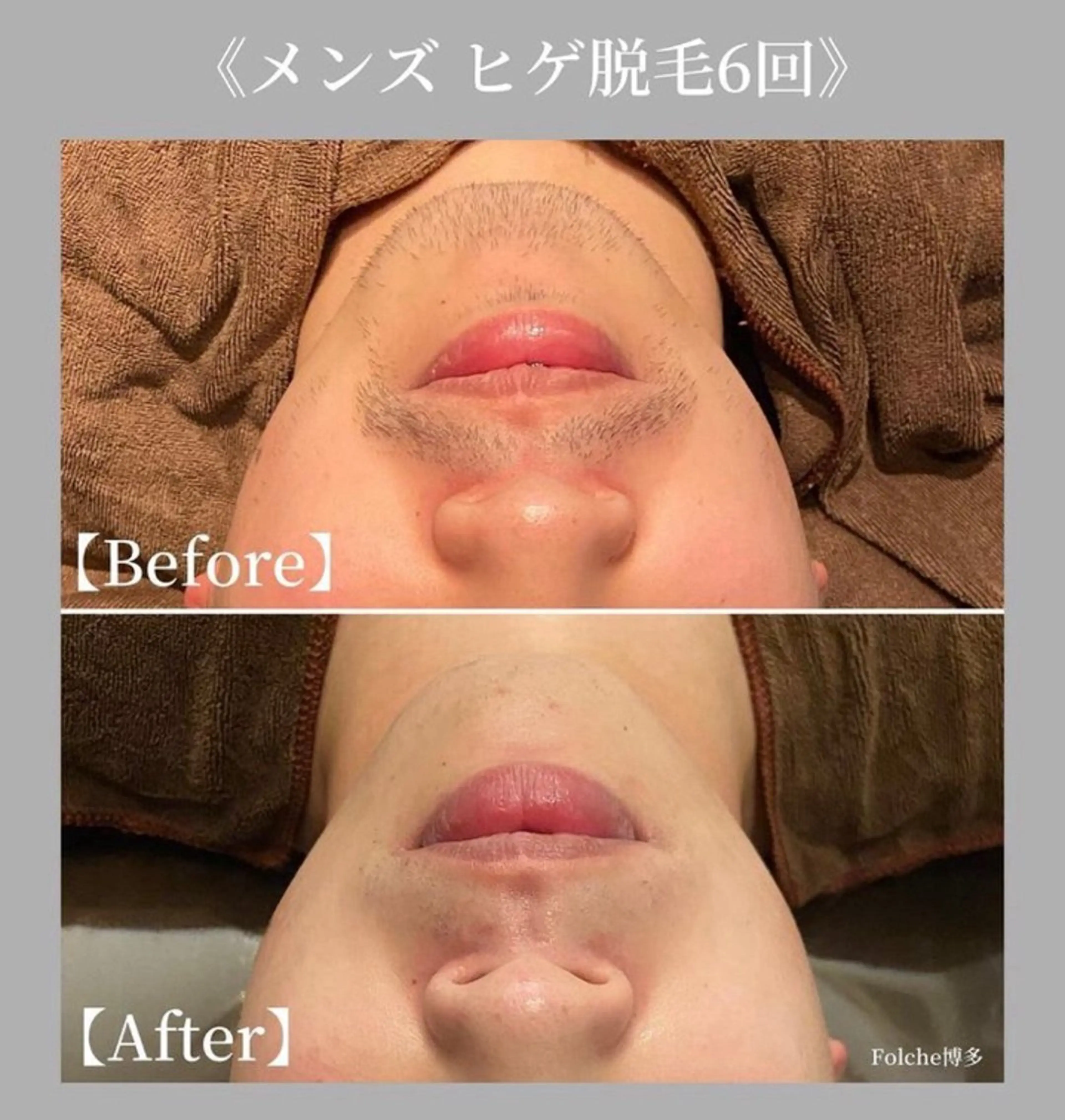 【Folche 春日店】馬場・大内田のエステ・リラクイメージ