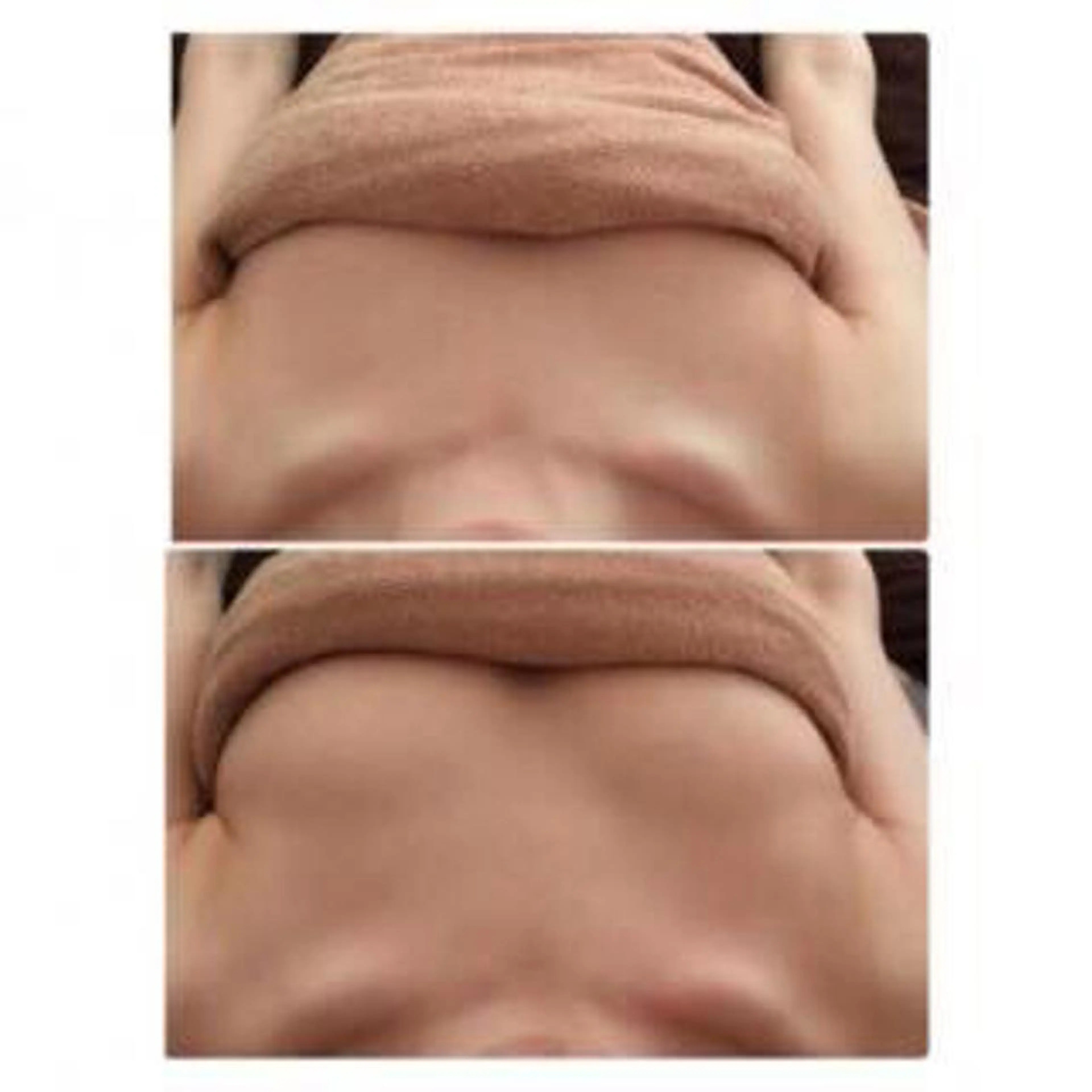 ミラクルウェーブ（バストアップ）＋コラーゲンマシン40分の写真