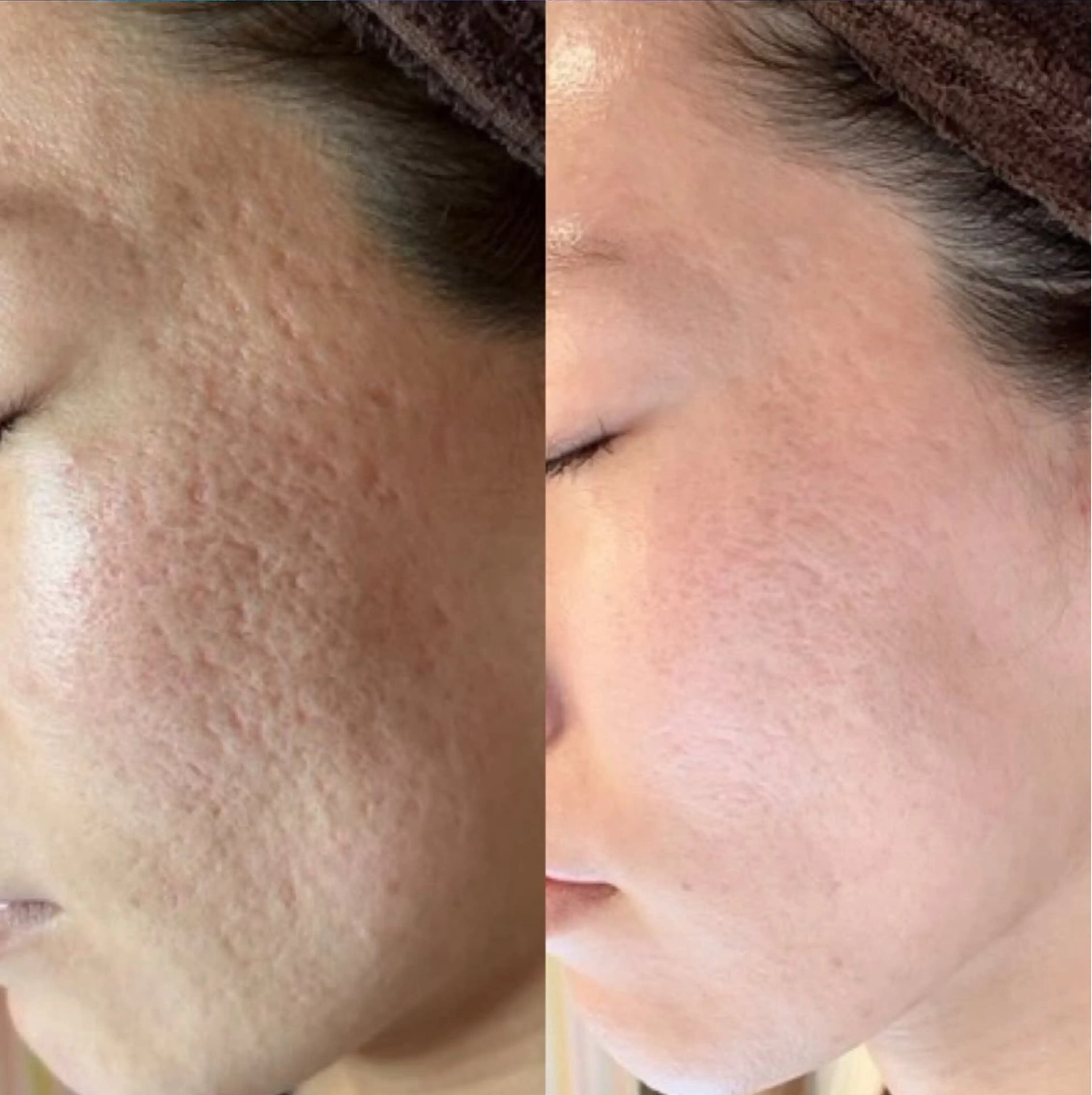 Blooming所属・LOUISE. ／肌質・頭皮のエステ・リラクイメージ