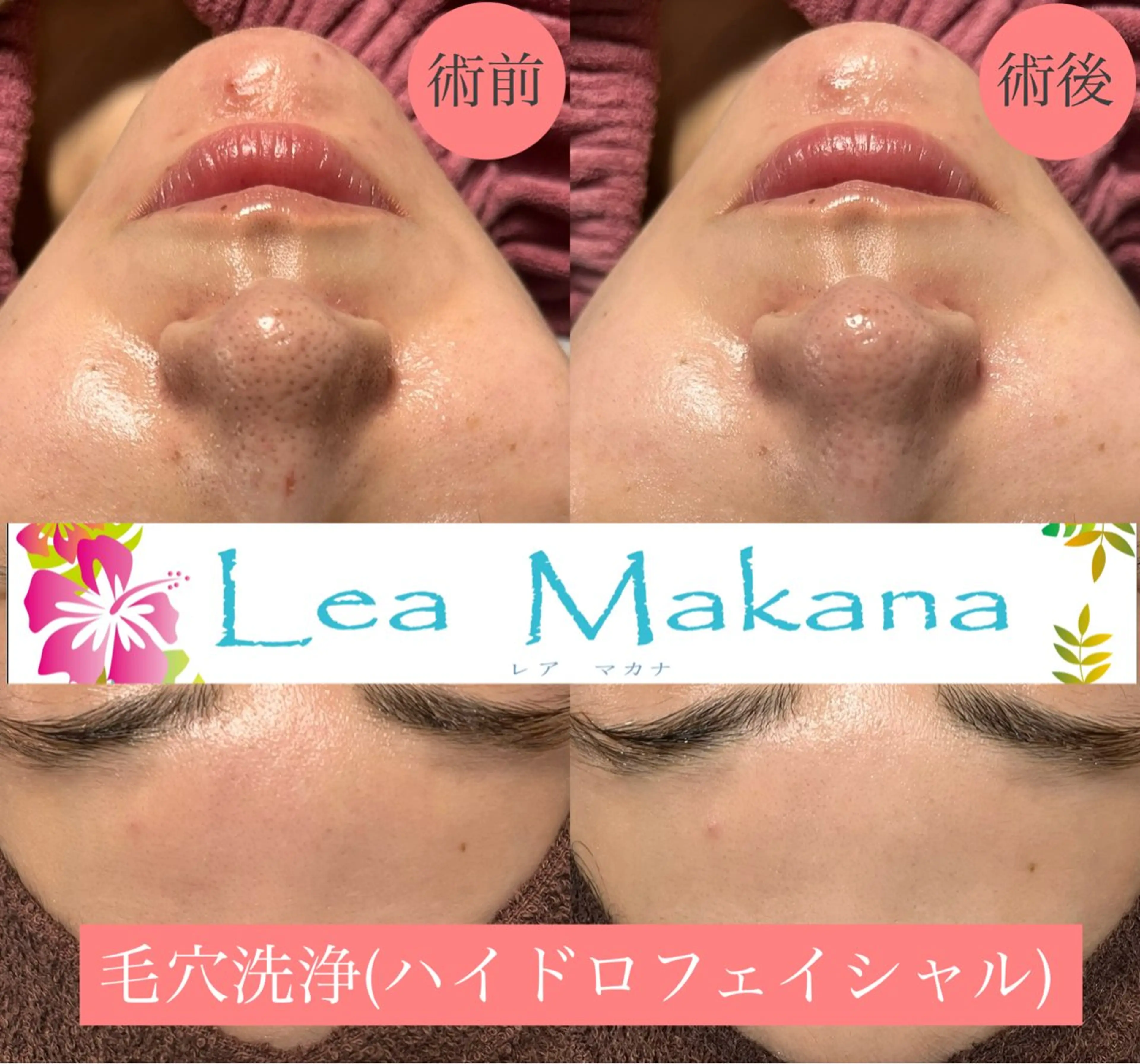 エステ Lea Makana-レアマカナ所属・毛穴洗浄🍀脱毛🍀 光フェイシャル🍀のエステ・リラクイメージ