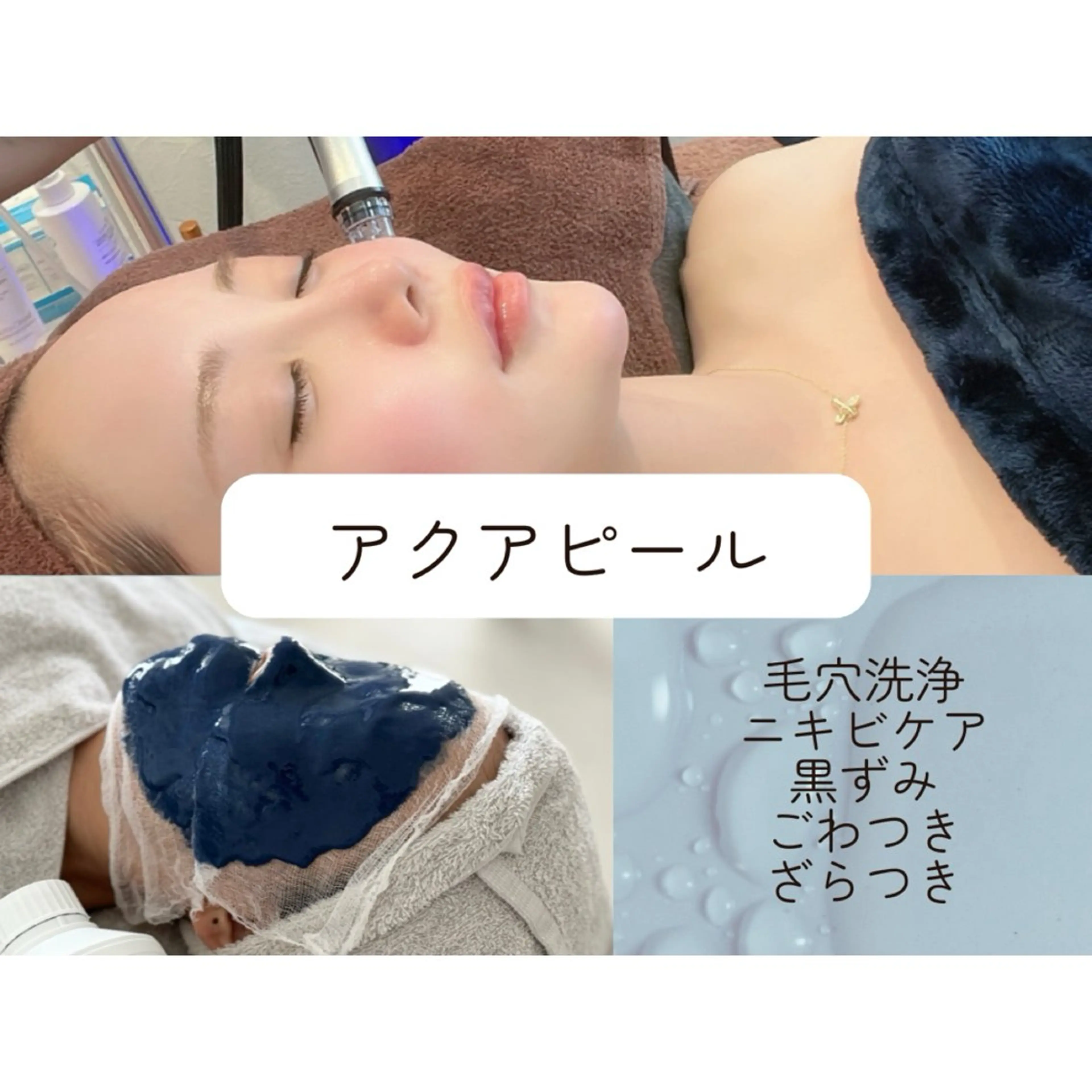 【アクアピール】韓国式毛穴洗浄！美容液でピーリングしながら毛穴を洗浄+美容成分を毛穴に閉じ込める♪モデリングマスク付きの写真