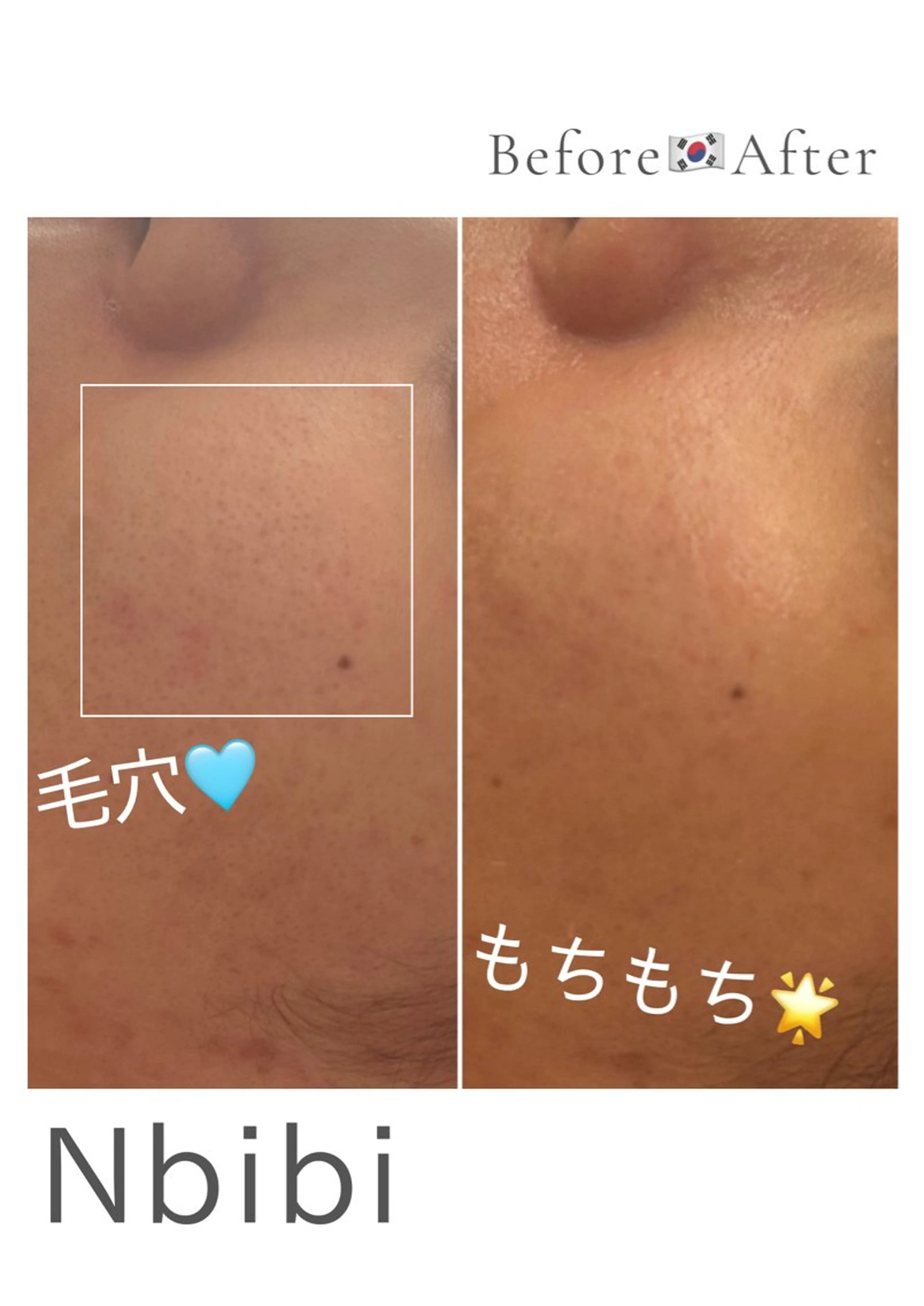 韓国🇰🇷価格 サロン_Nbibiのエステ・リラクイメージ