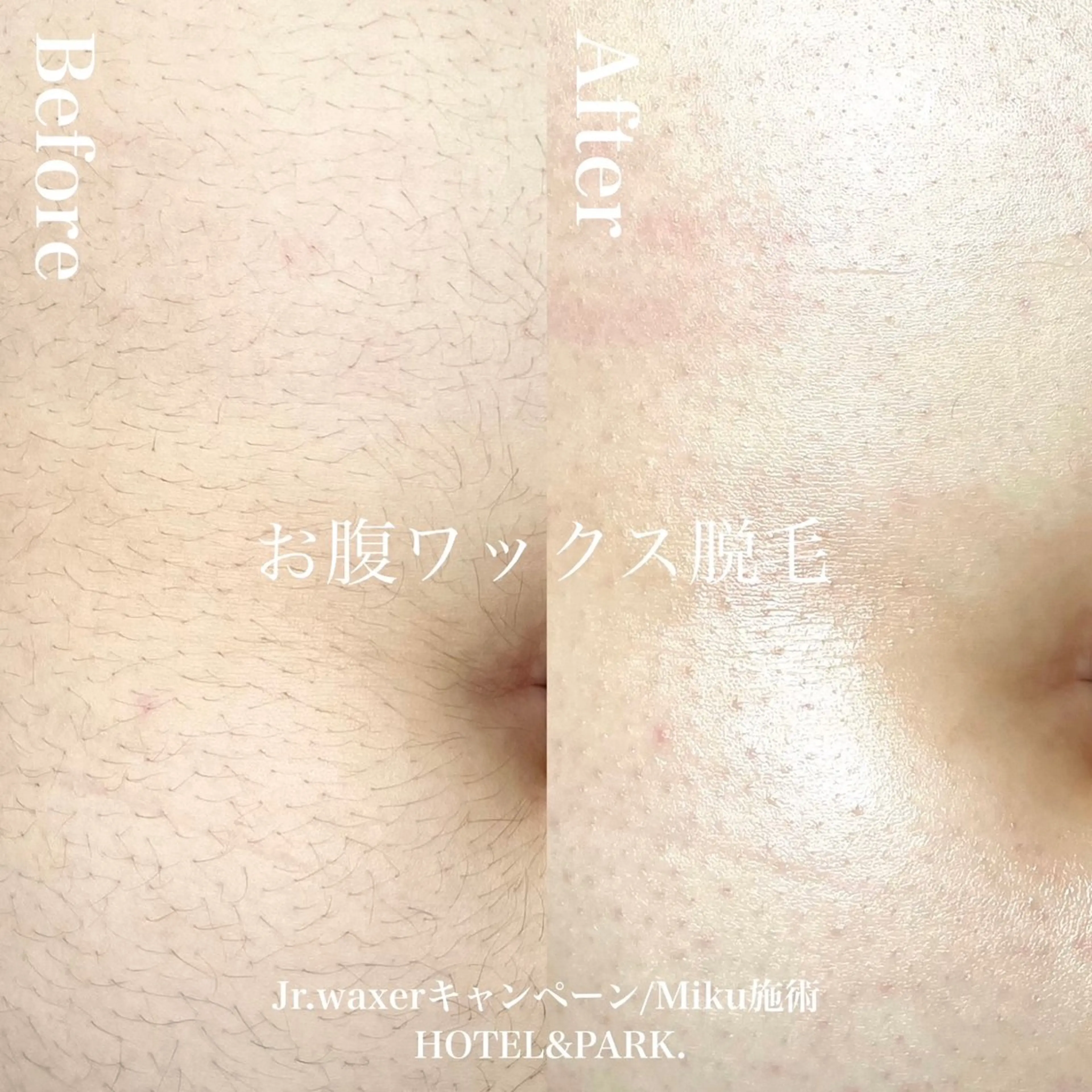 HOTEL&PARK Mikuワックス脱毛のエステ・リラクイメージ