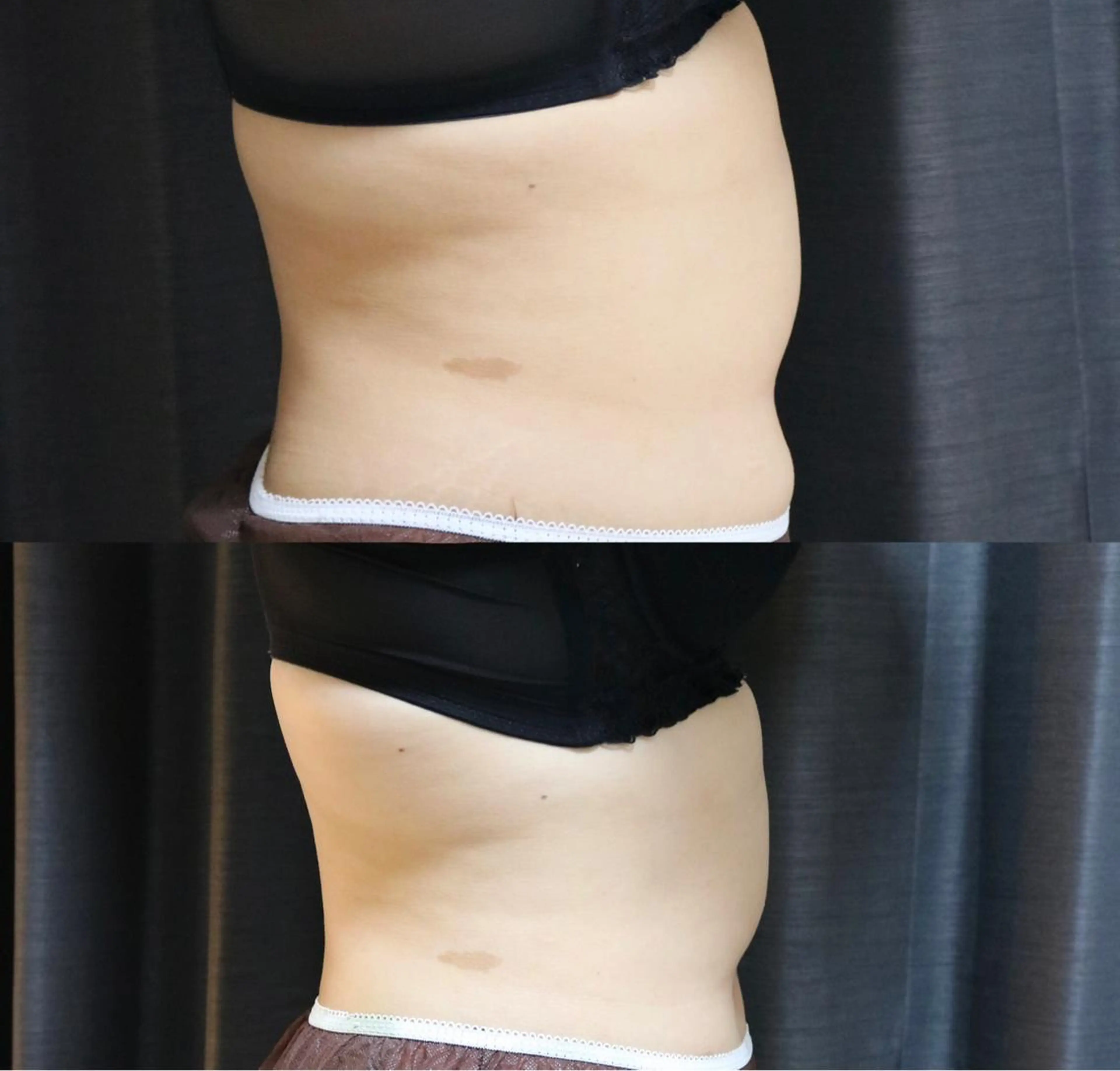 エステ リラク 整♡深層リンパ ronronのその他イメージ