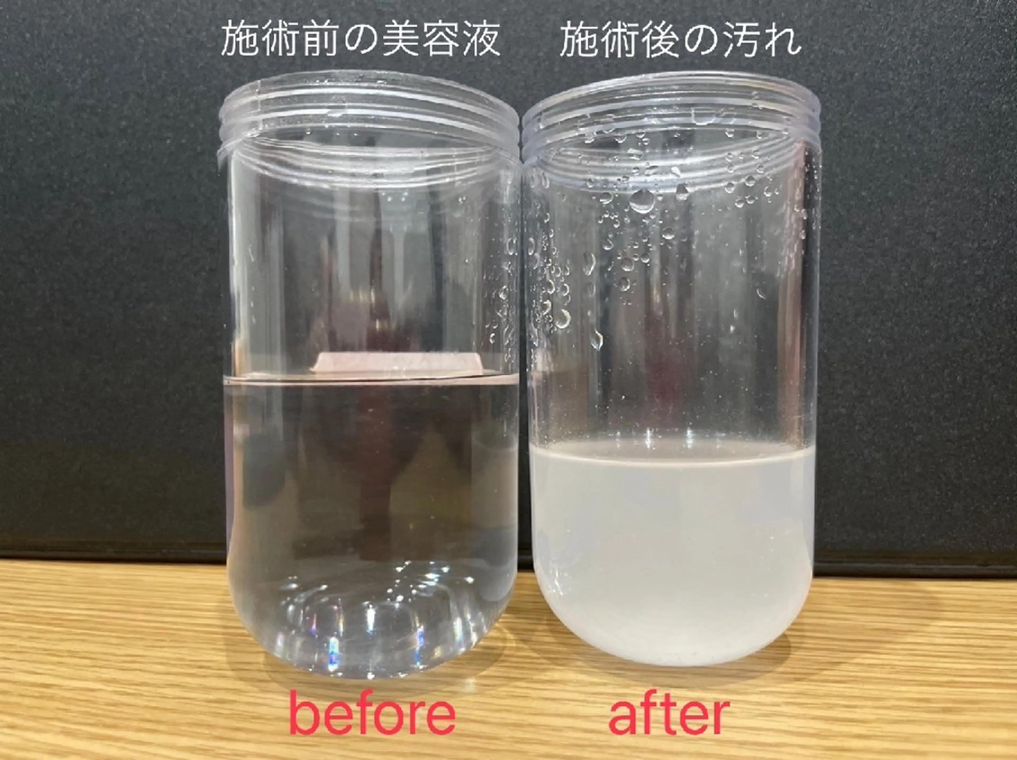 特別クーポン【期間限定】ハイドラ毛穴洗浄2980円の写真