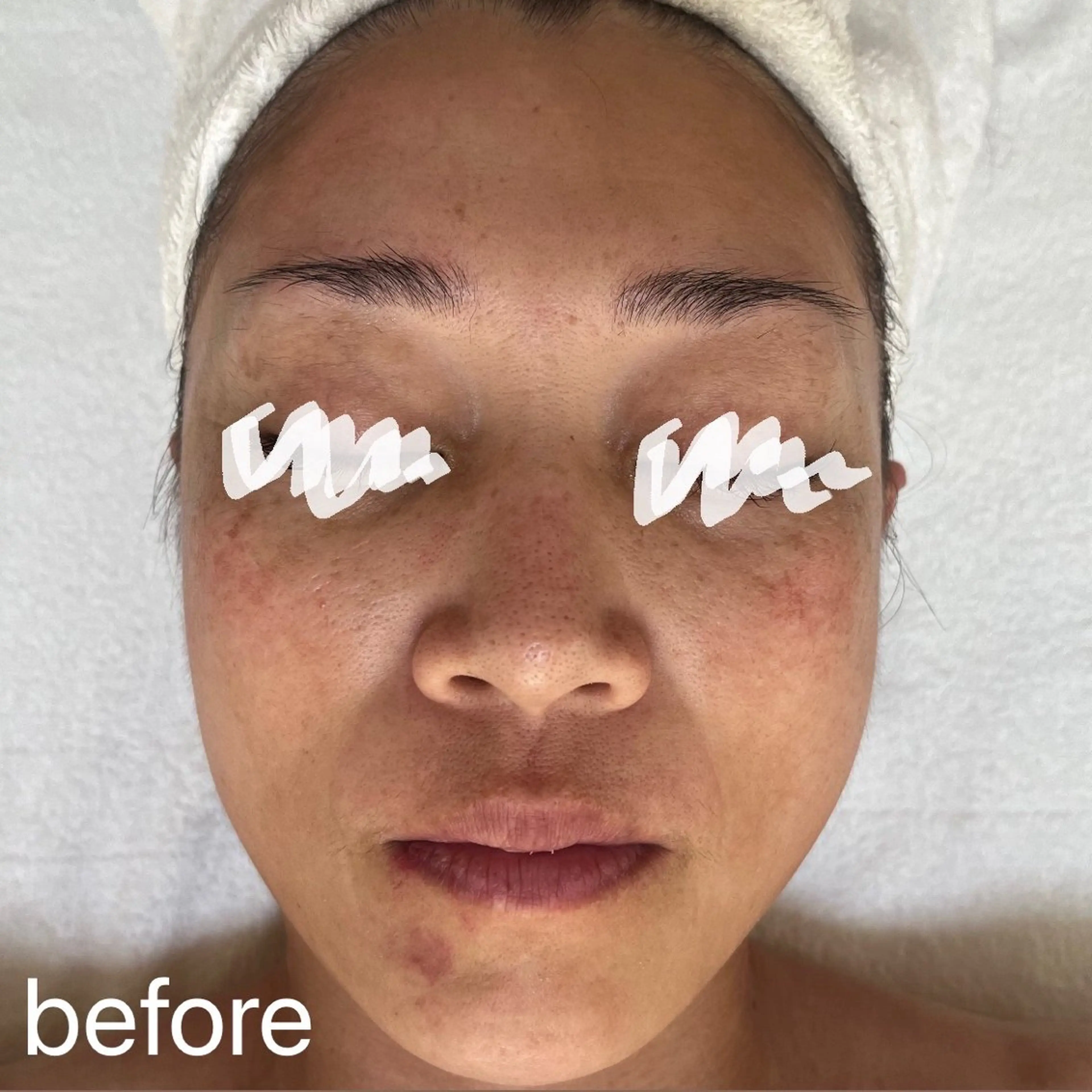 エステ 肌質改善|天王寺 For...はるかのエステ・リラクイメージ