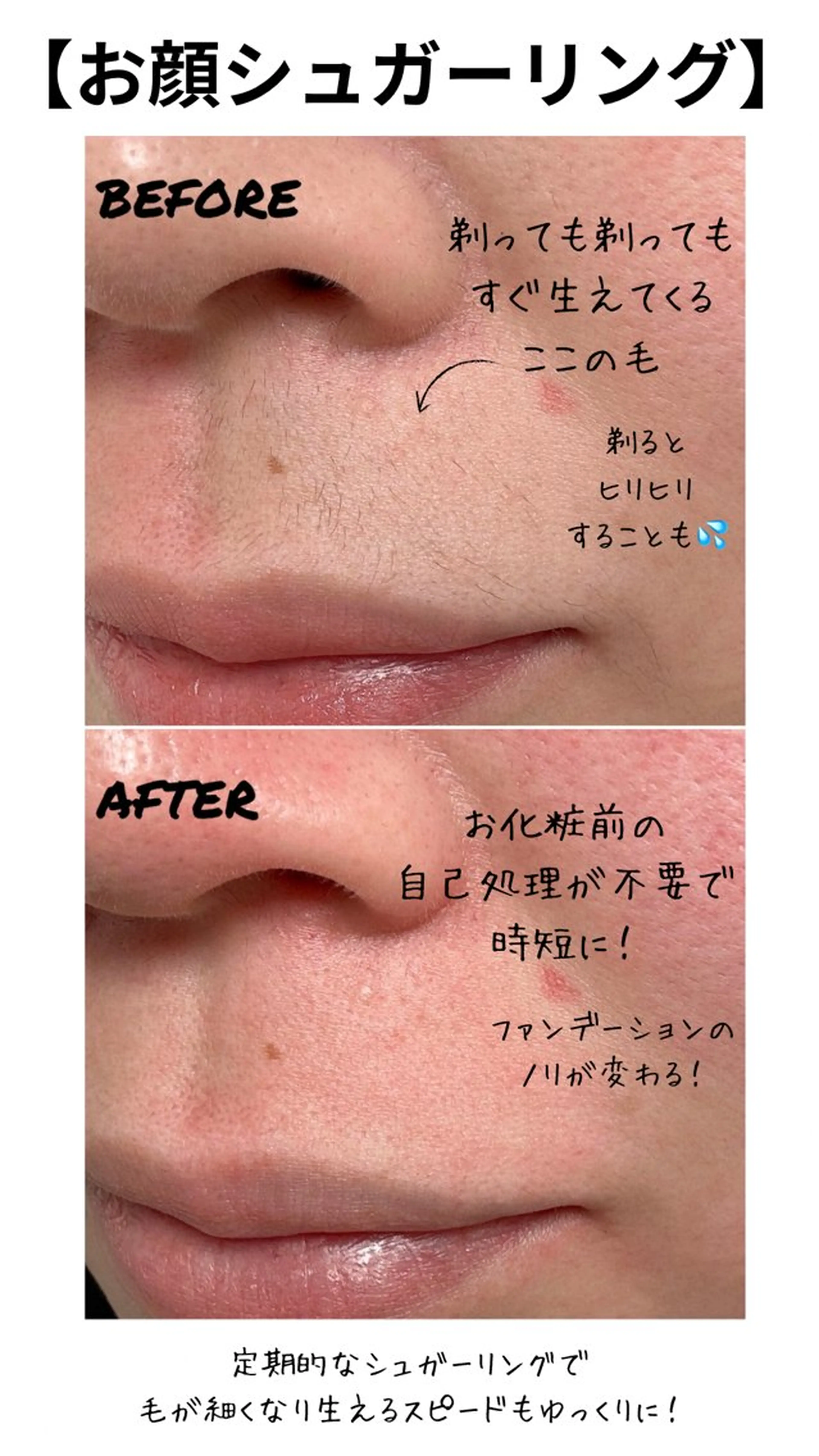 脱毛 シュガーリング 【MARLS】の眉毛・アイブロウイメージ