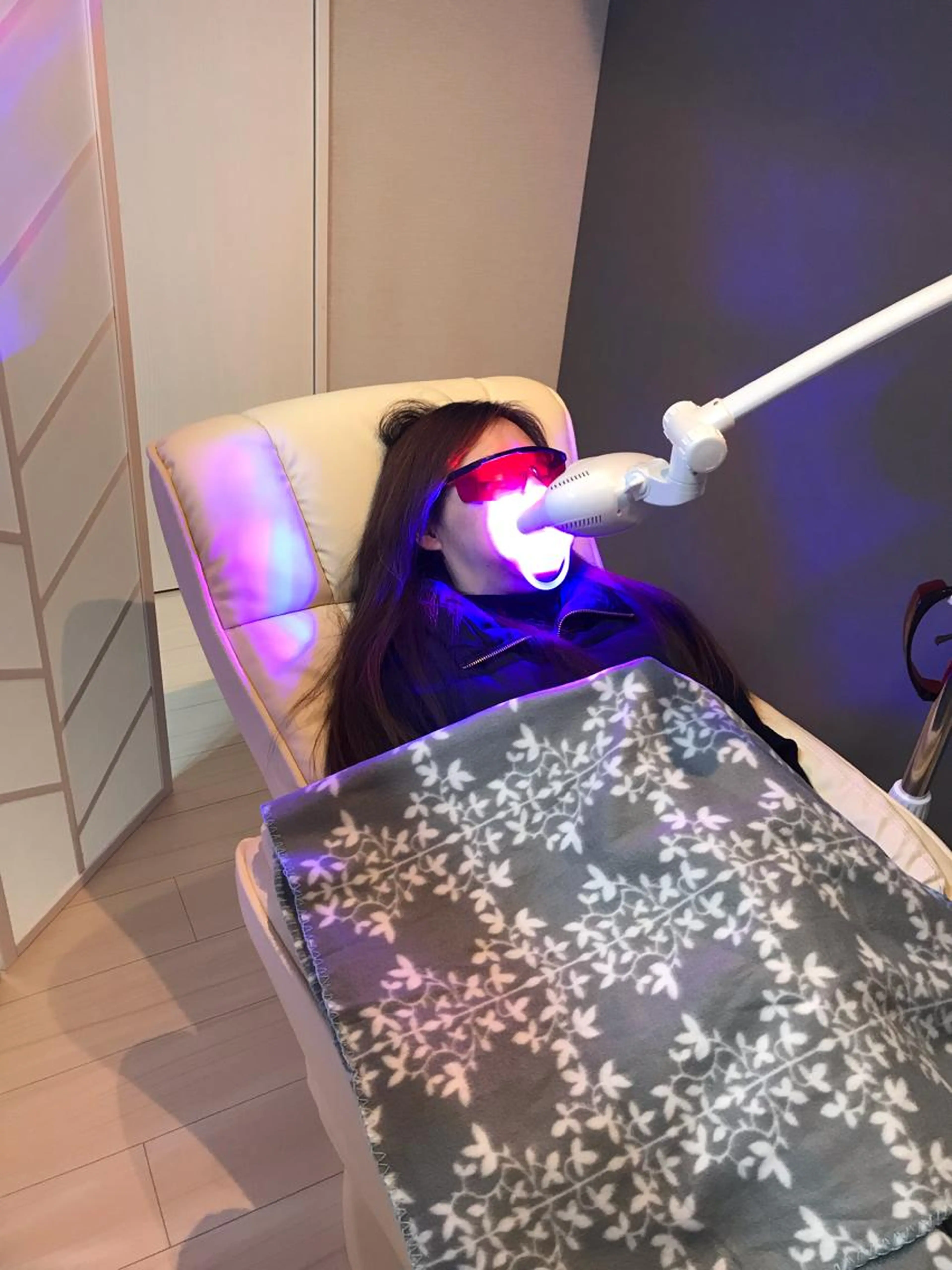 セルフホワイトニング2回目以降　2時間フリーの写真