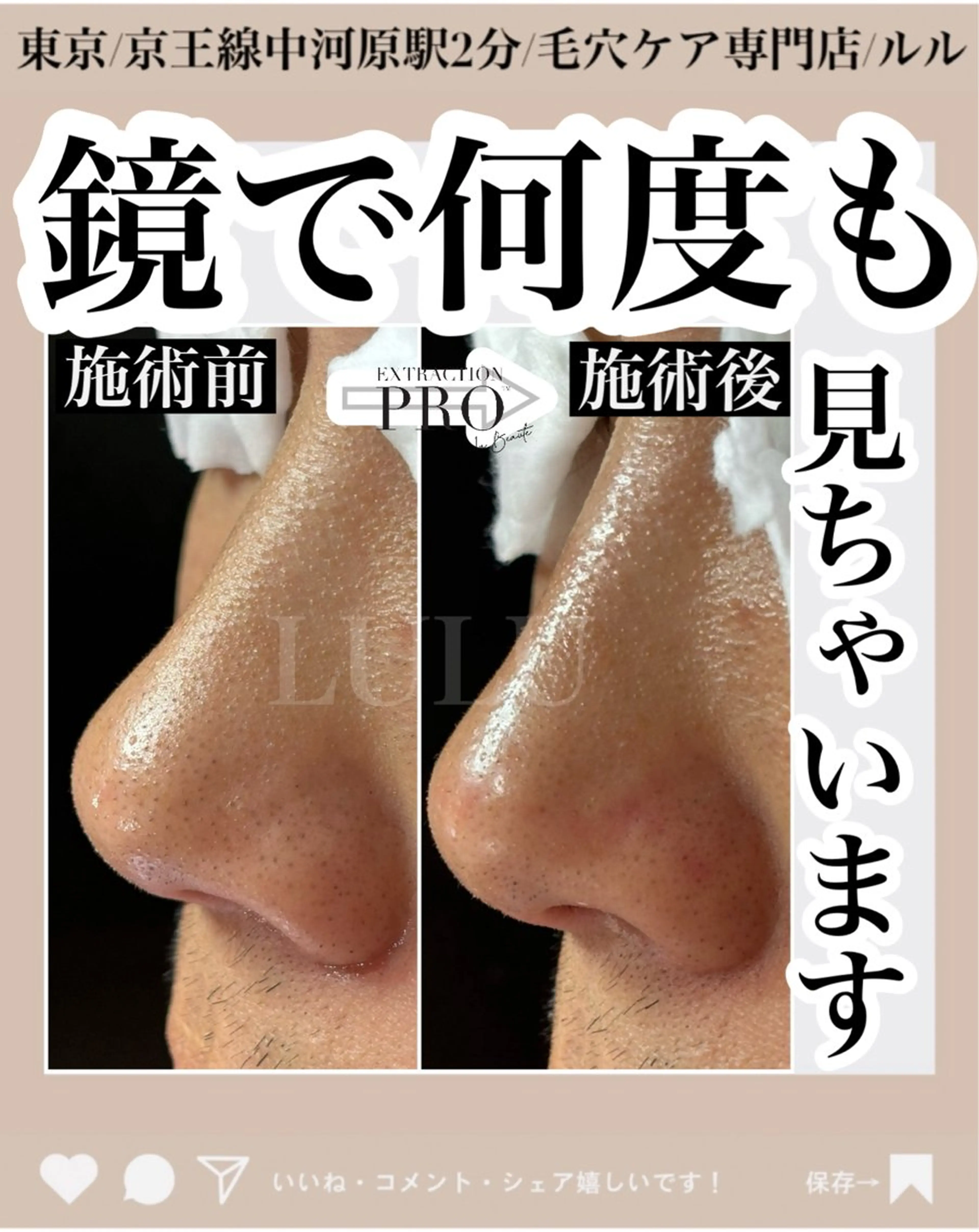 エステ LULU所属・LULU ルルのエステ・リラクイメージ