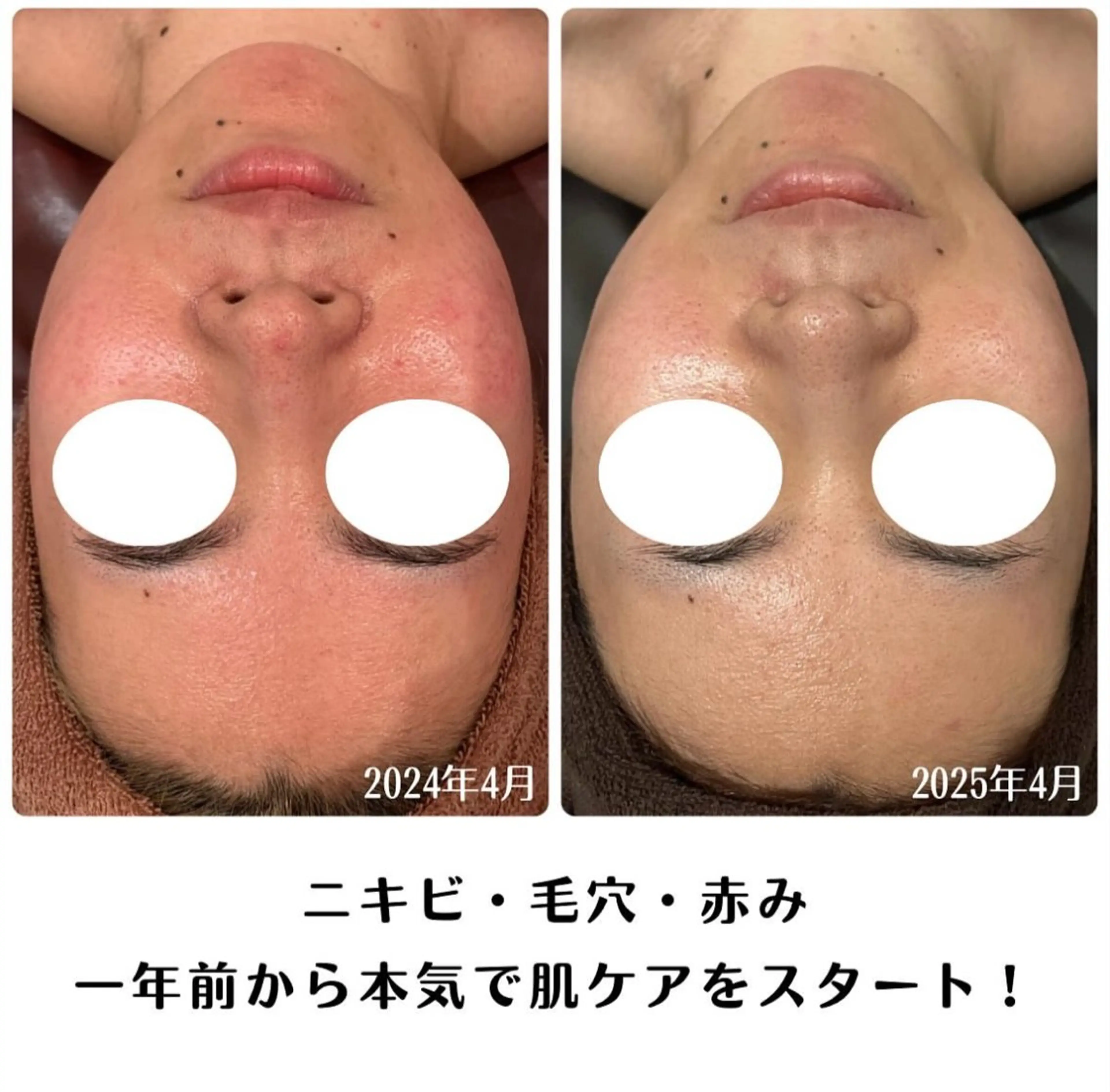 LutanRiche青森店所属・ルタンリッシュ 青森店のエステ・リラクイメージ