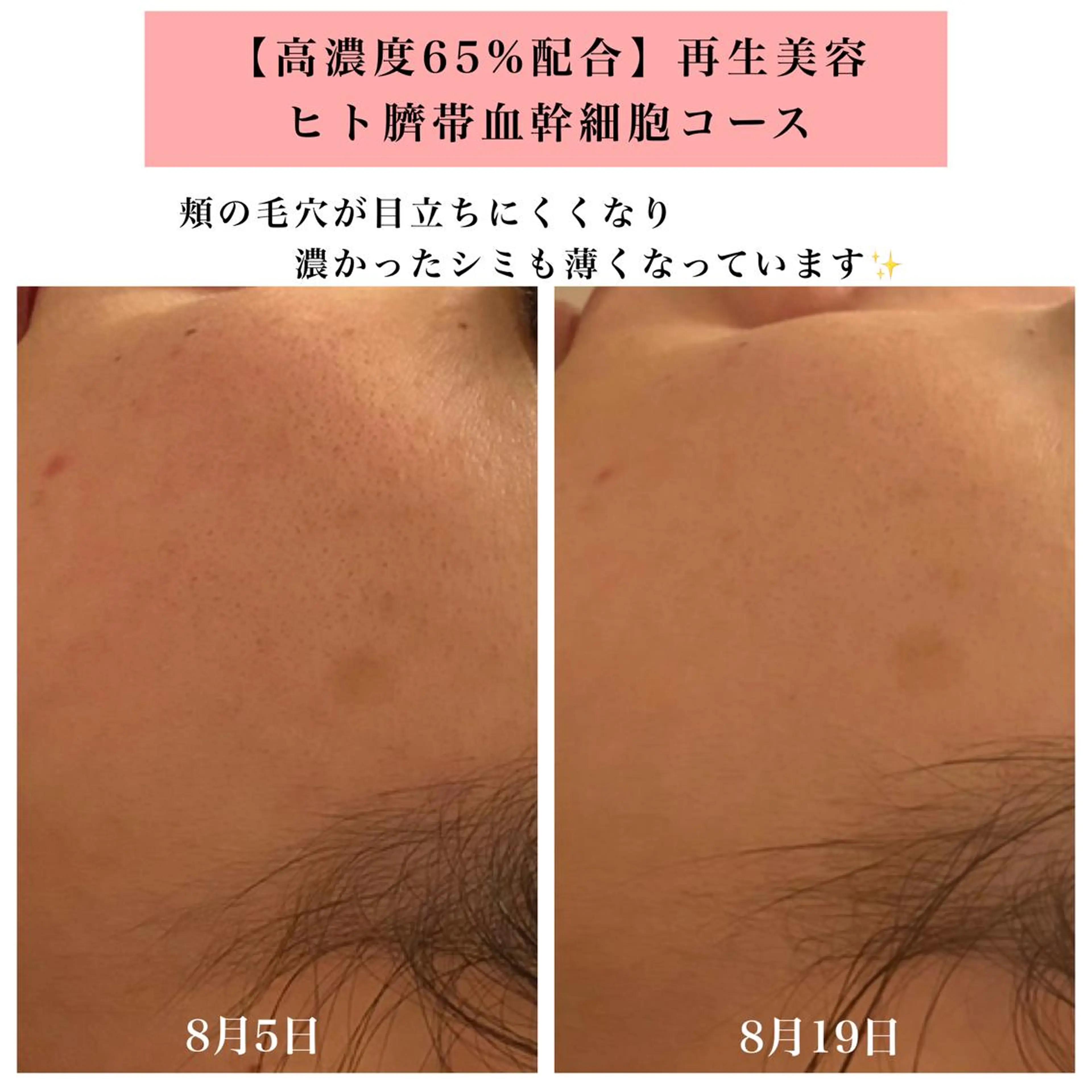 エステ リラク Bellesthe （ベルエステ）のエステ・リラクイメージ