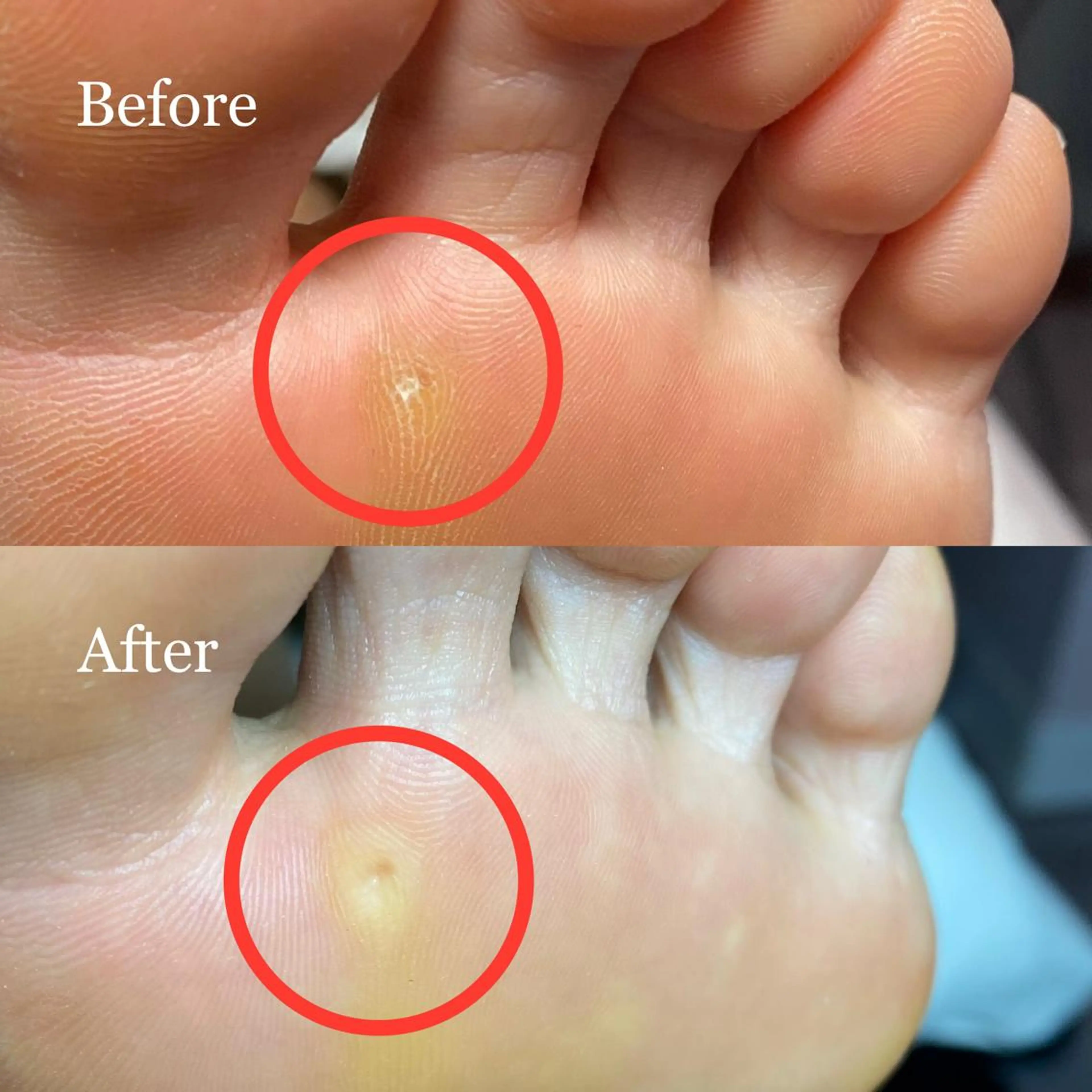 ネイル 長さ出し フットネイル ジェルネイル 〜Nail Tailor〜　ネイルテイラー所属・NailTailor ネイルテイラーのネイルデザイン