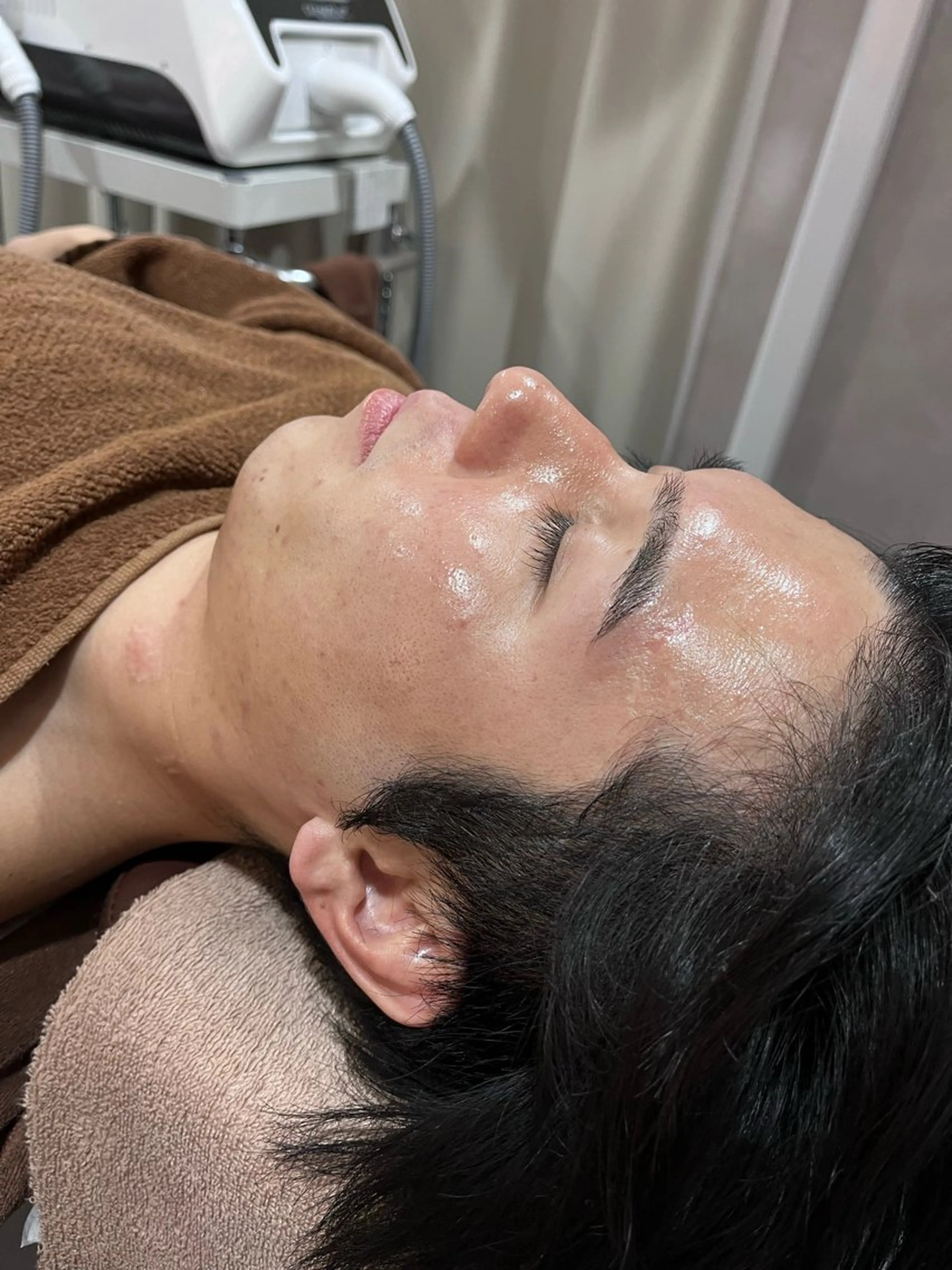 【メンズ限定！】毛穴洗浄×ヒゲ脱毛✨✨の写真