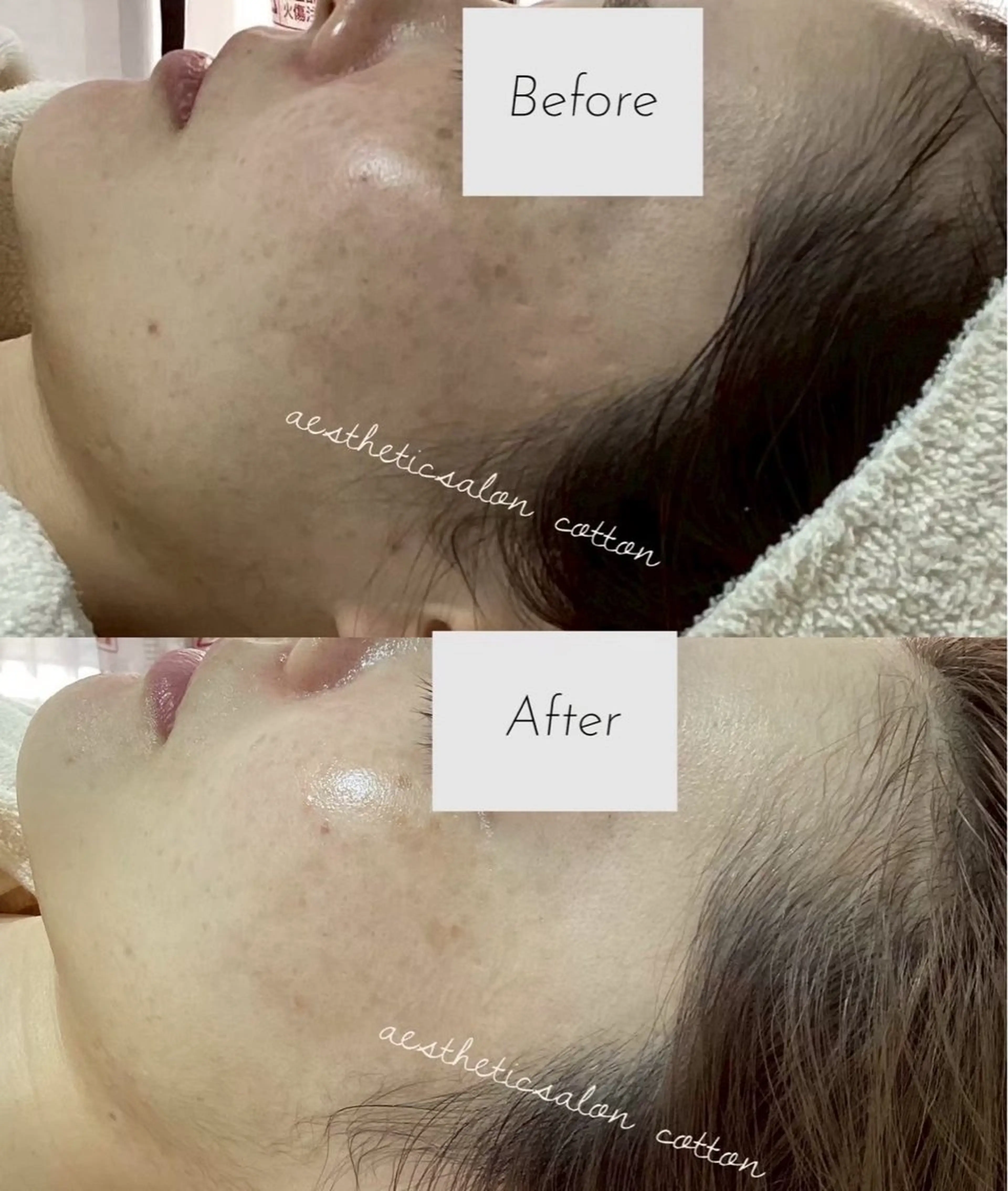 エステ 都度払い 肌質改善専門サロンのエステ・リラクイメージ