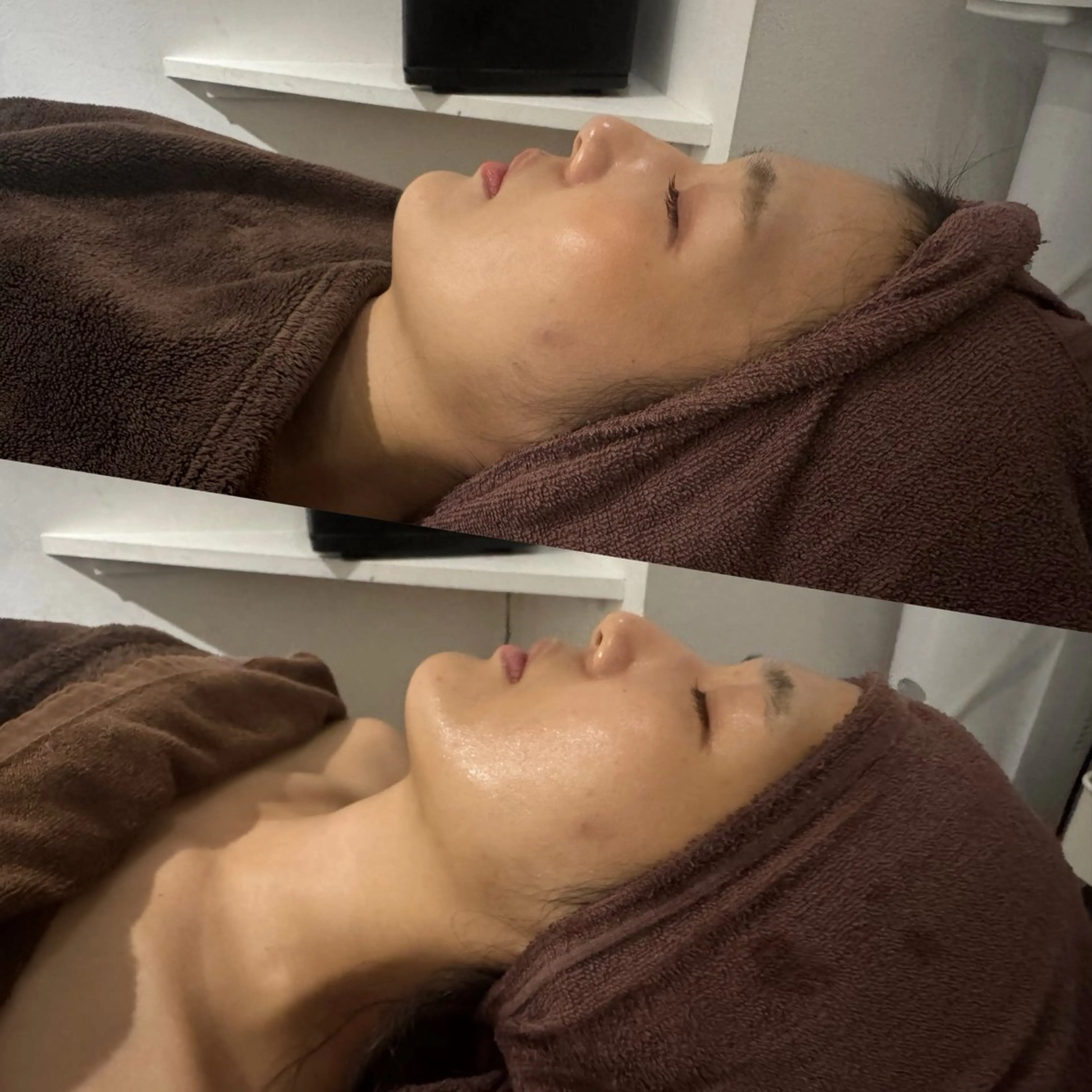 ニキビケア専門サロン Unityのエステ・リラクイメージ