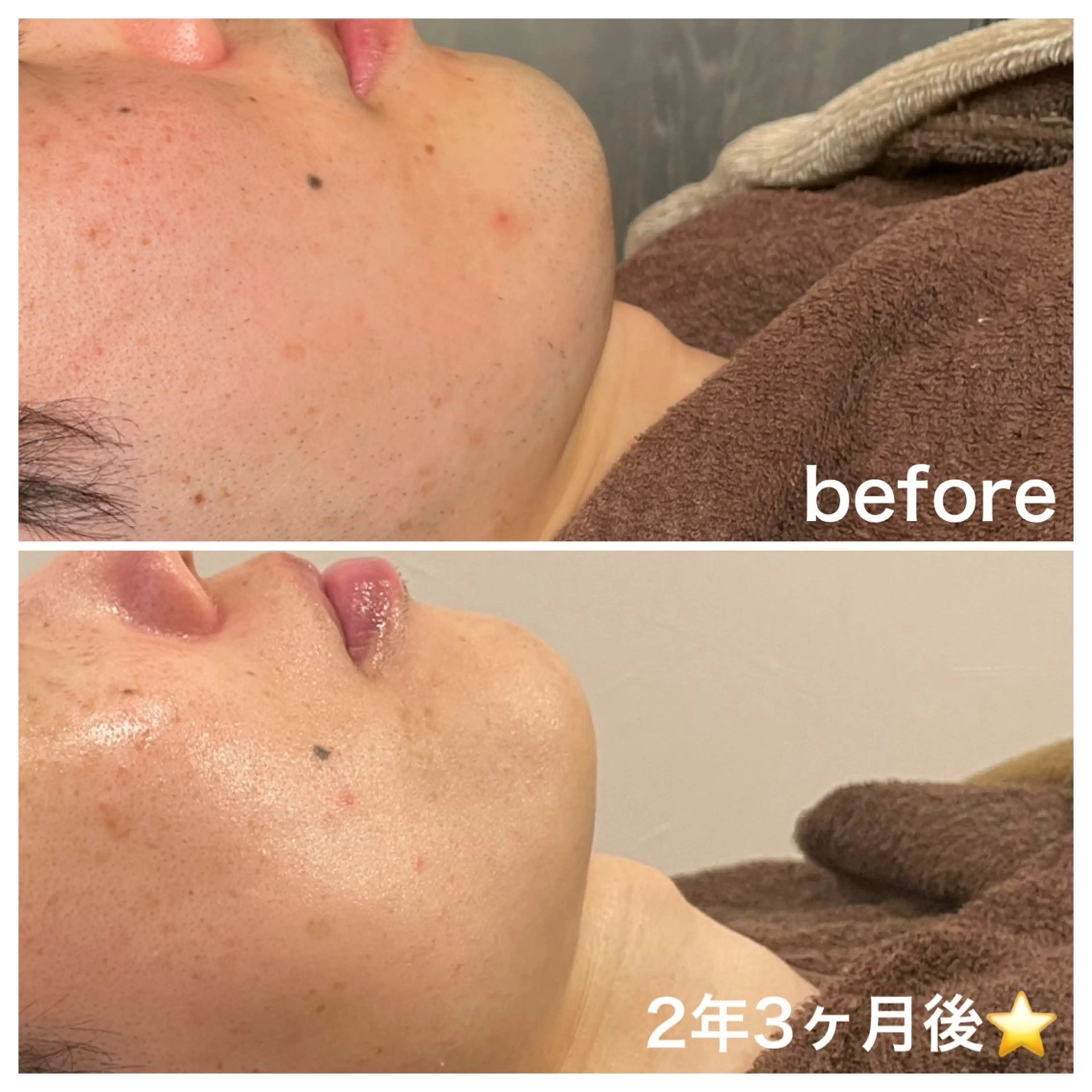 エステ 浜野 恵美のエステ・リラクイメージ