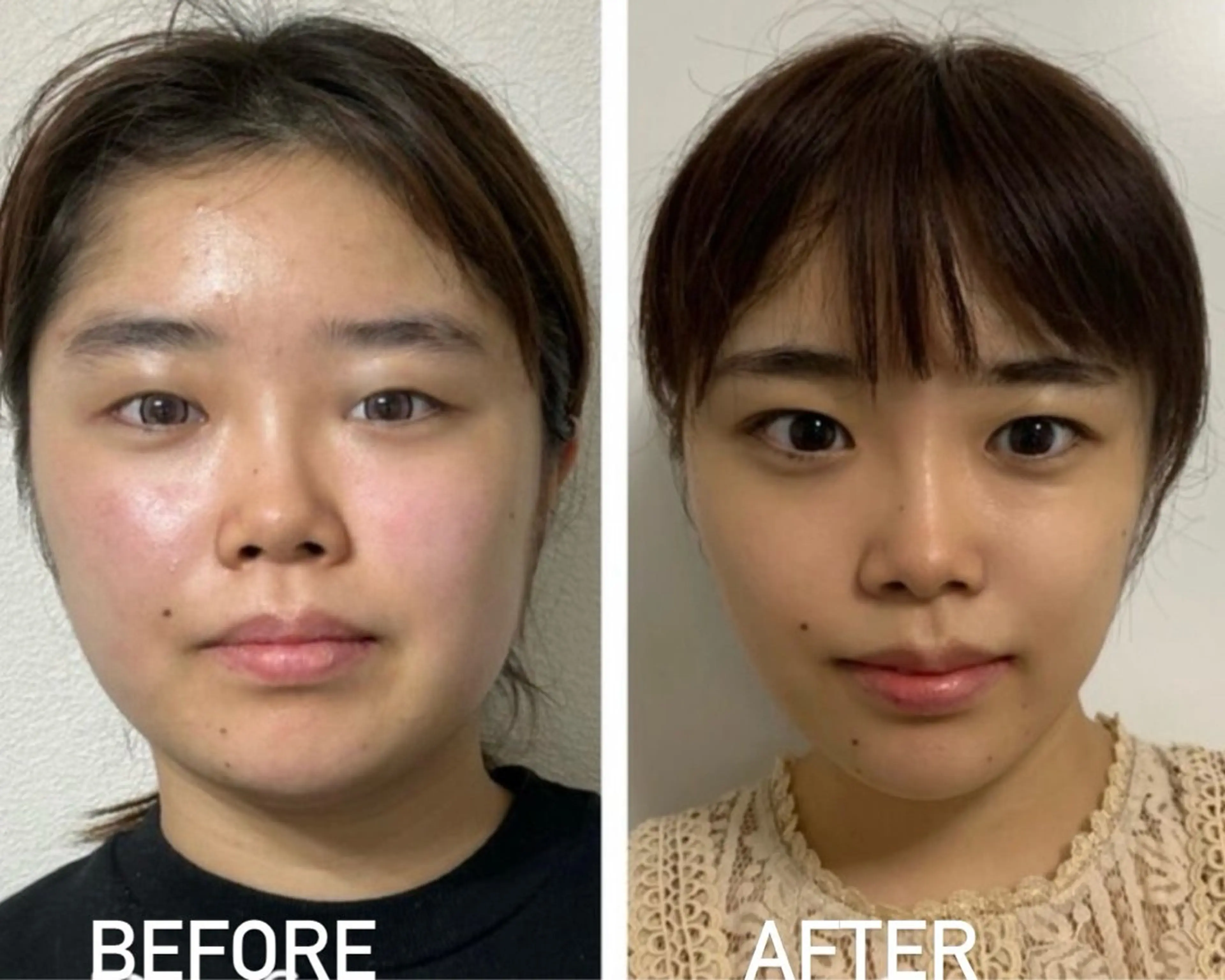 エステ 痩身岡崎メディカル所属・平野 ありさのエステ・リラクイメージ