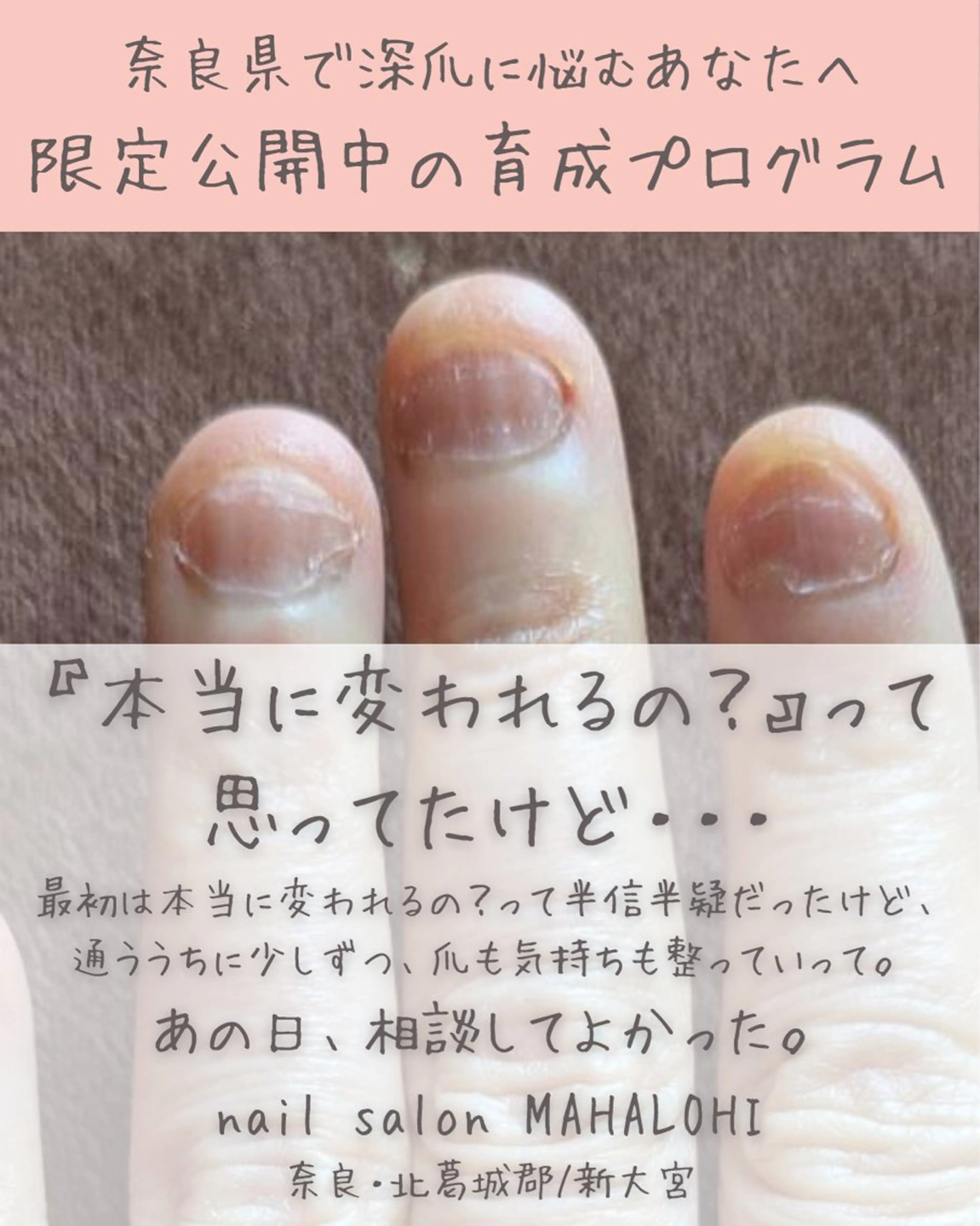 ネイル 深爪・自爪育成専門 MAHALOHIのネイルデザイン