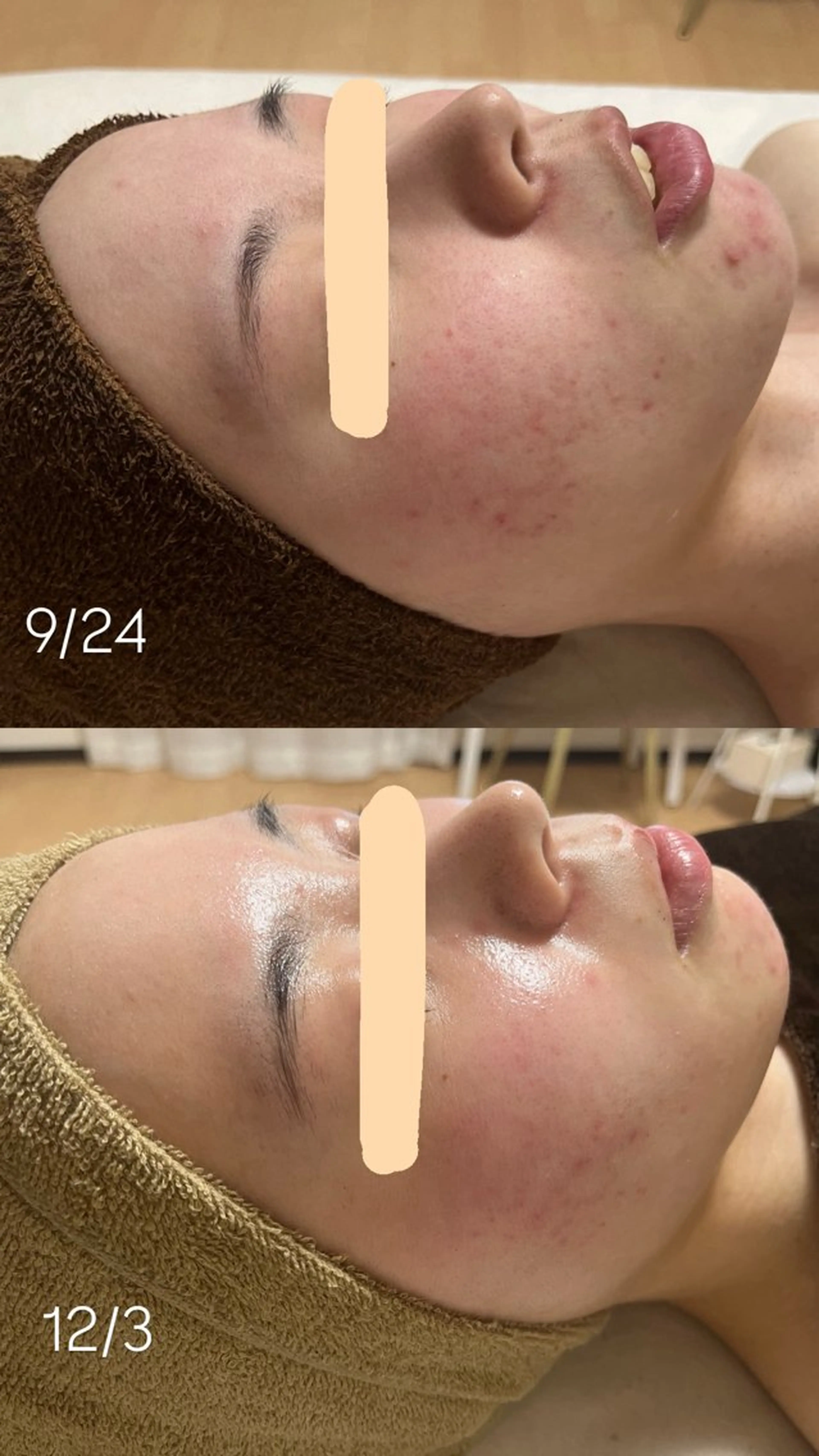 エステ salon More所属・出口 玲菜のエステ・リラクイメージ