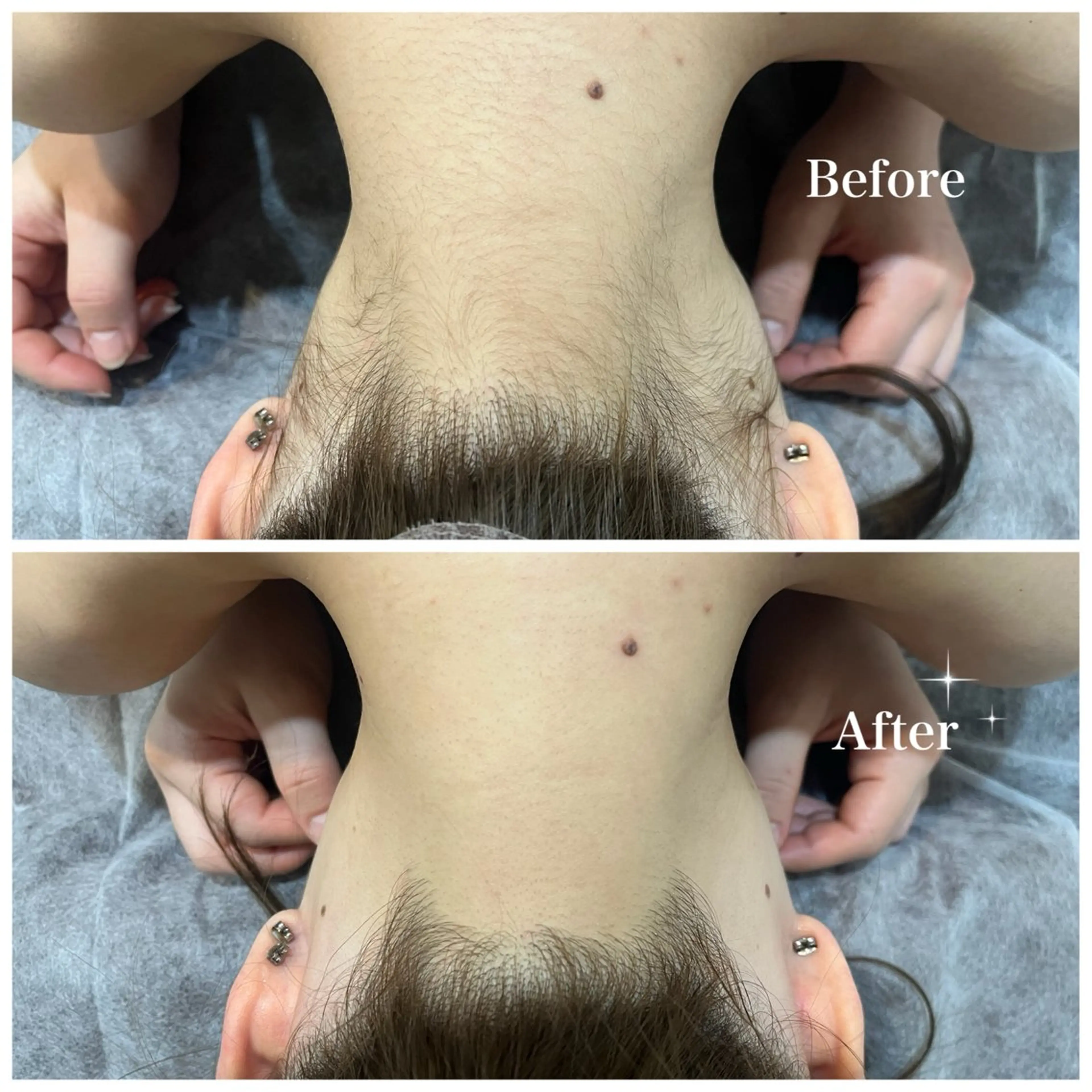 脱毛 脱毛サロン fam.豊澤柚良のエステ・リラクイメージ