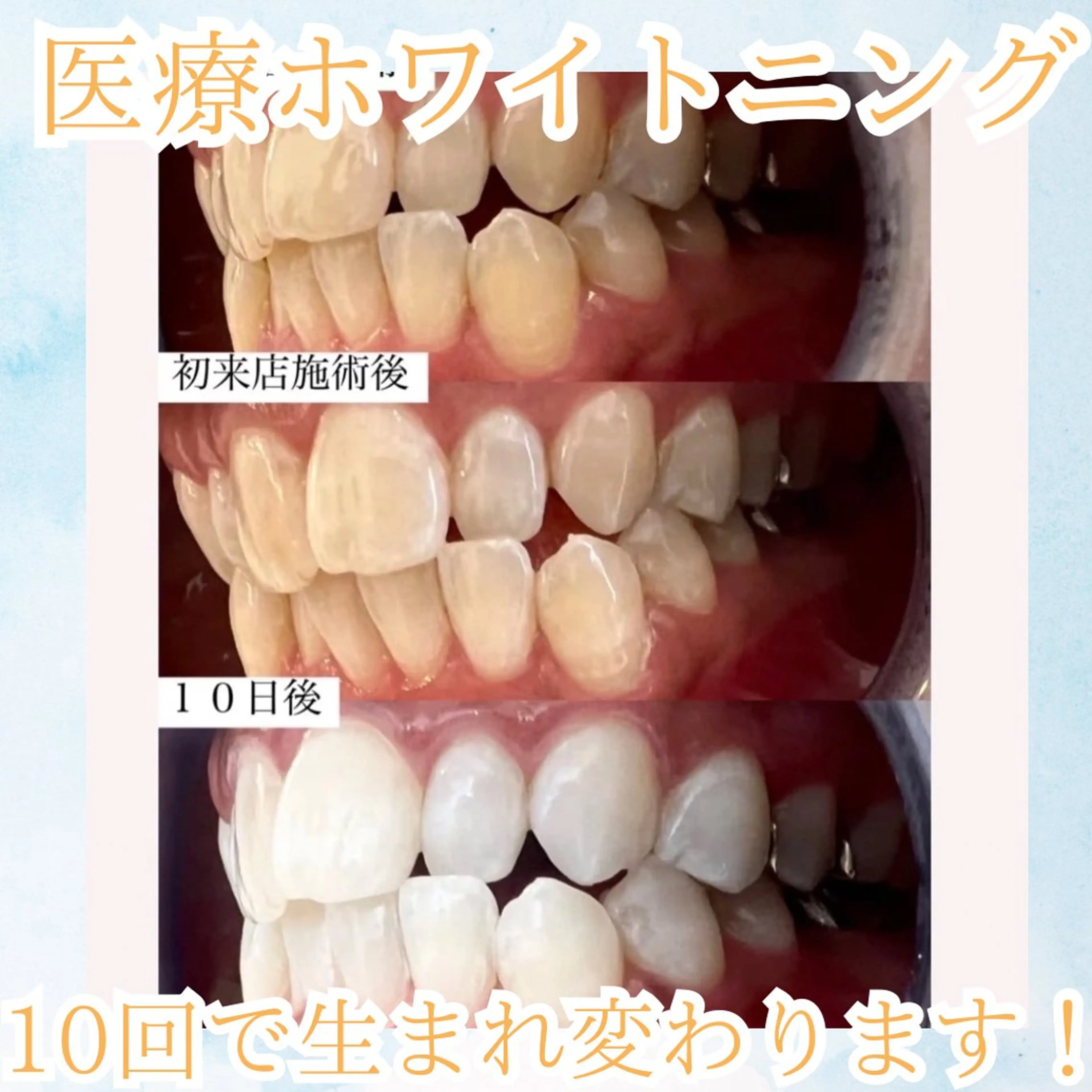 メンズ エステ リラク ホワイトニング専門店 WHITE天神店のエステ・リラクイメージ