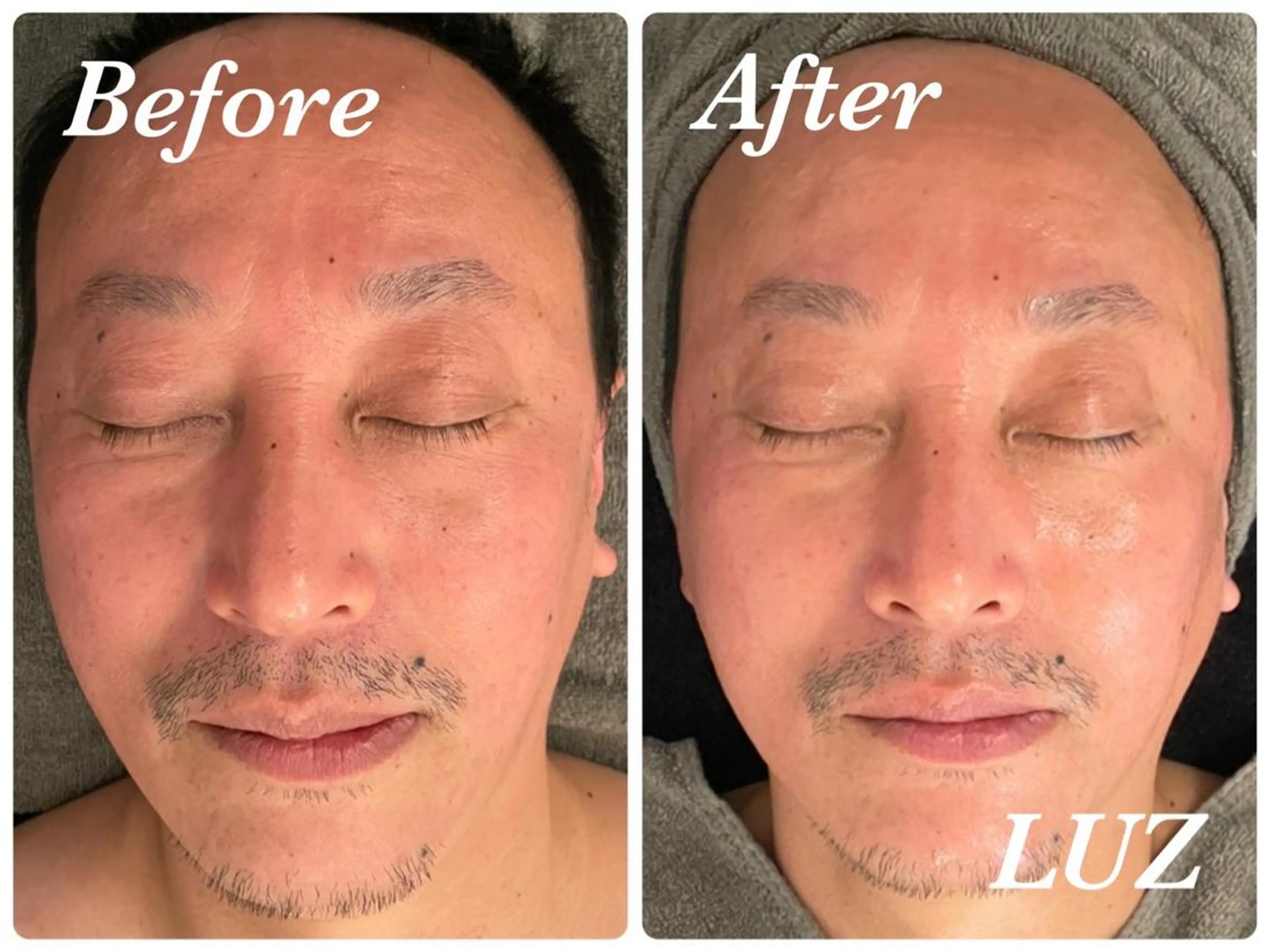 メンズ メンズフェイシャル アイブロウ・ルースのエステ・リラクイメージ