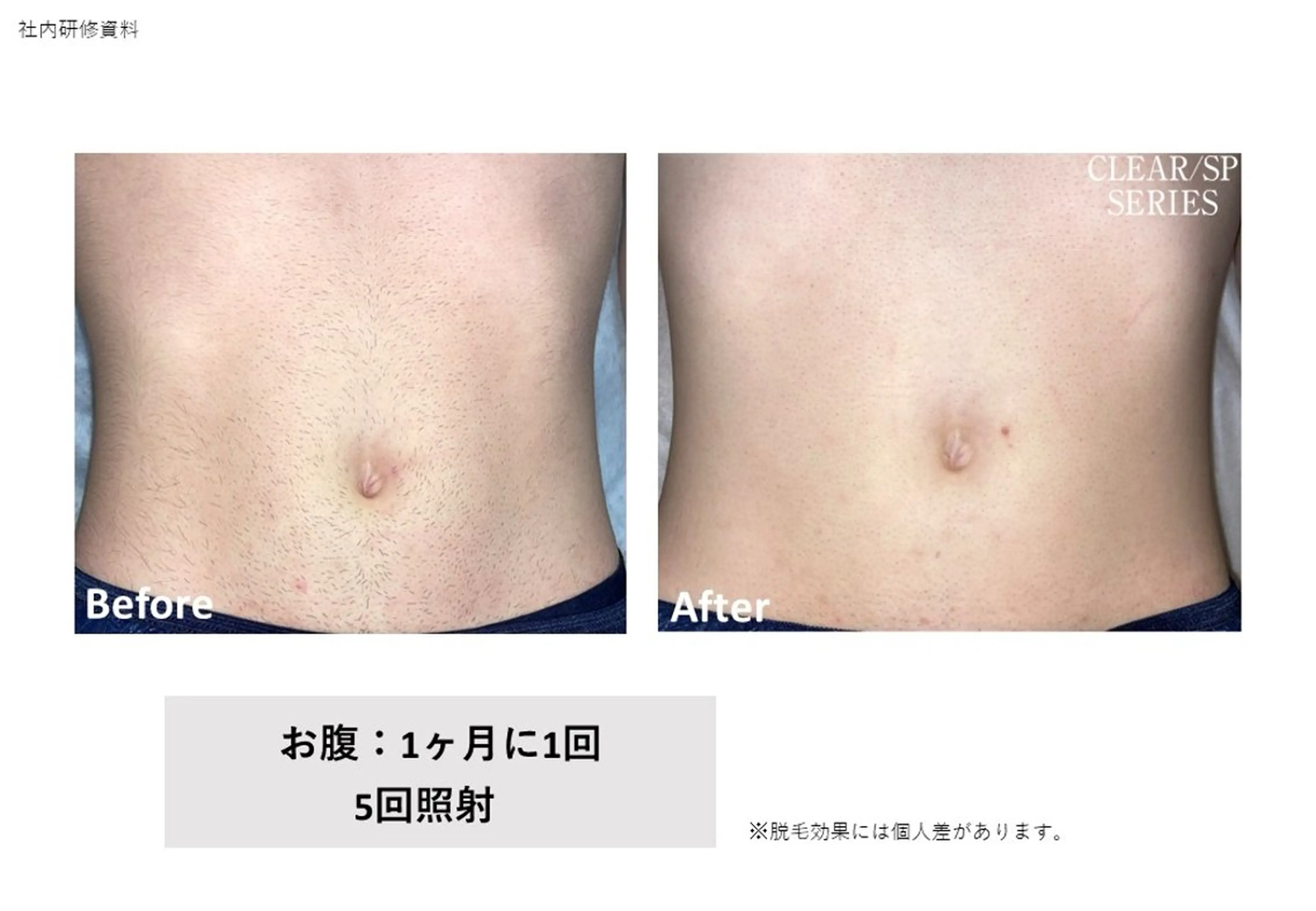 VIERU YURIのネイルデザイン