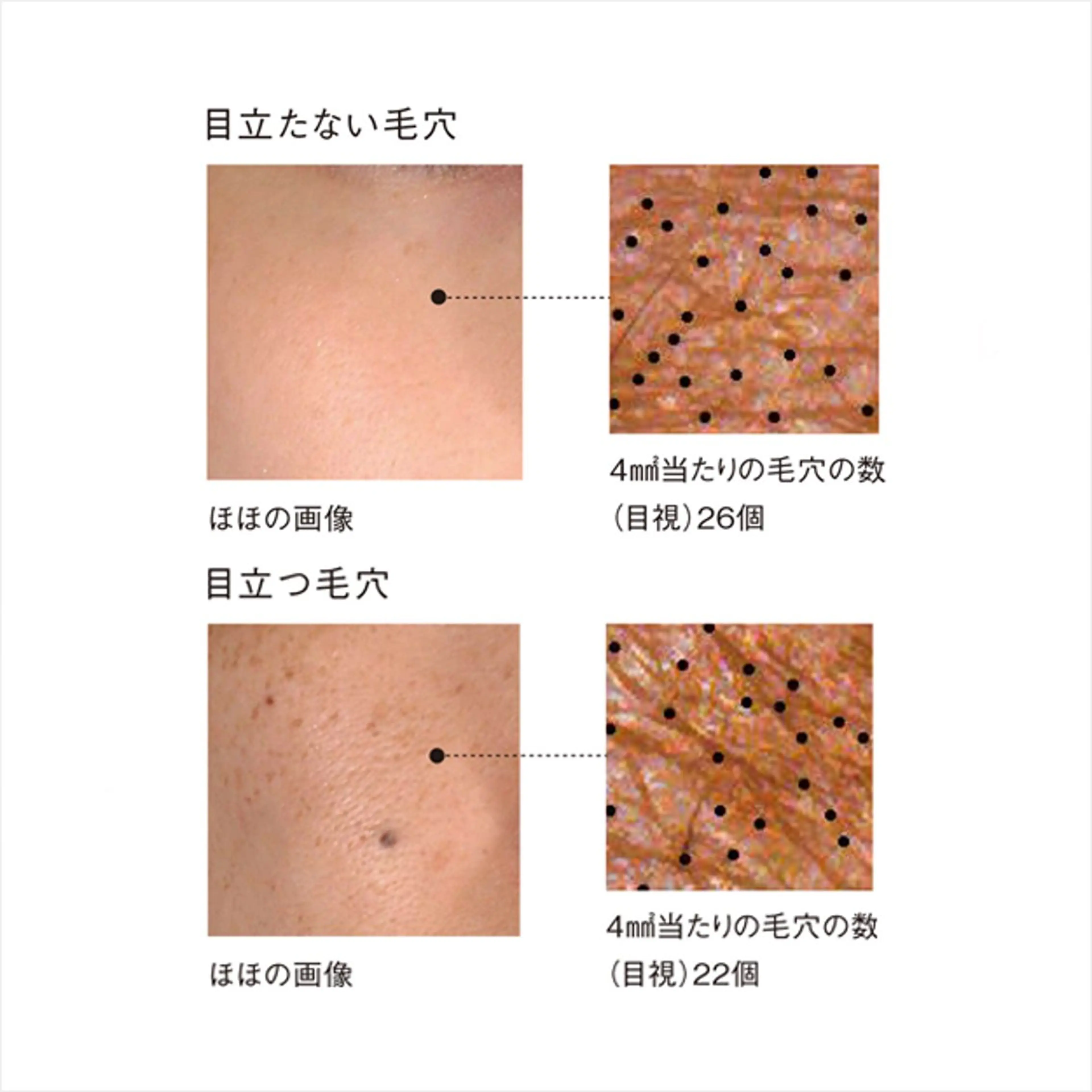 毛穴にお悩みの方向け。毛穴の原因とケアをお伝えします。ポーラの肌分析　お肌に合わせたサンプルプレゼント🎁の写真