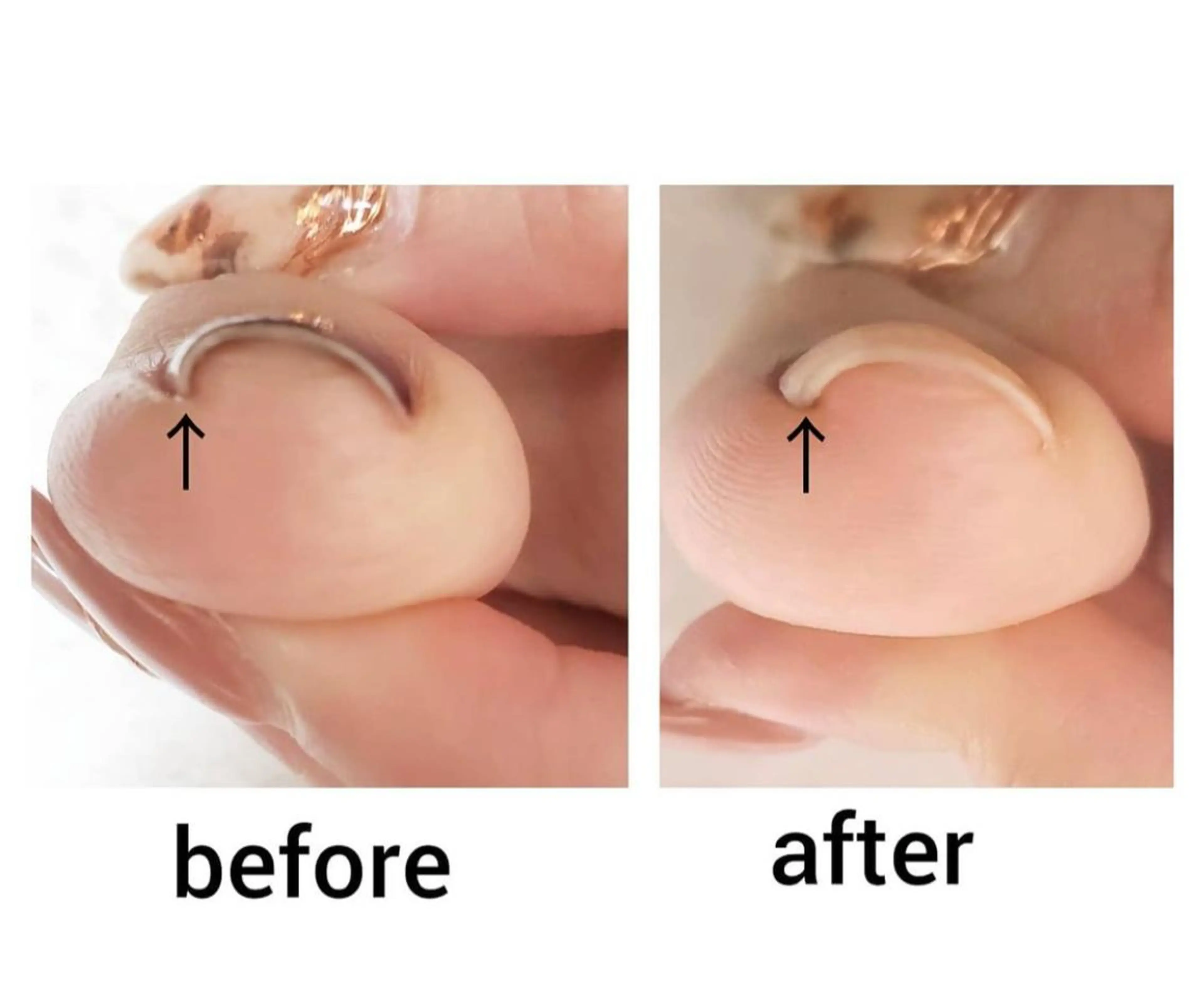 ネイル Nail Rinonのネイルデザイン