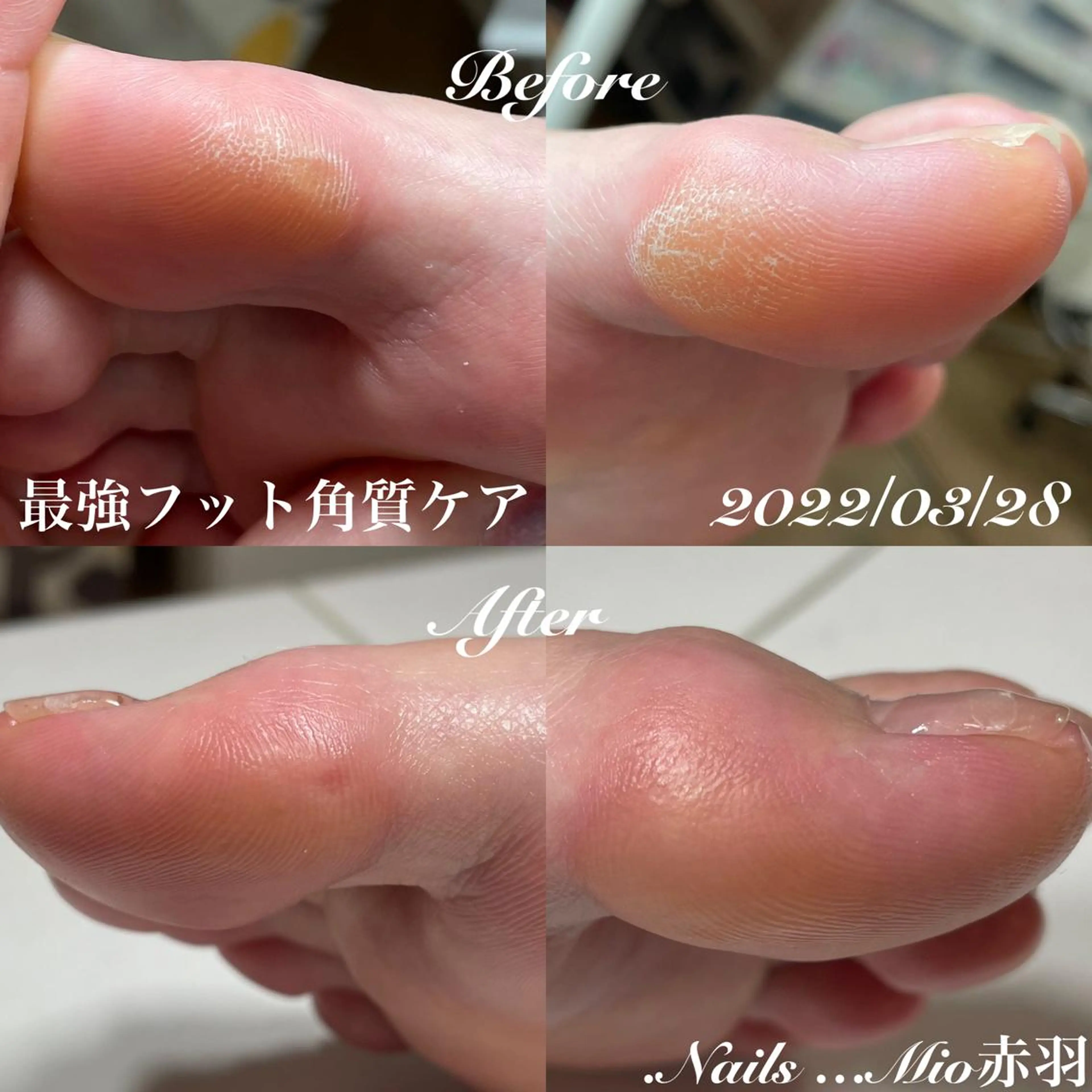 ネイル フットネイル .Nails Mio 赤羽西ネイルサロンのネイルデザイン