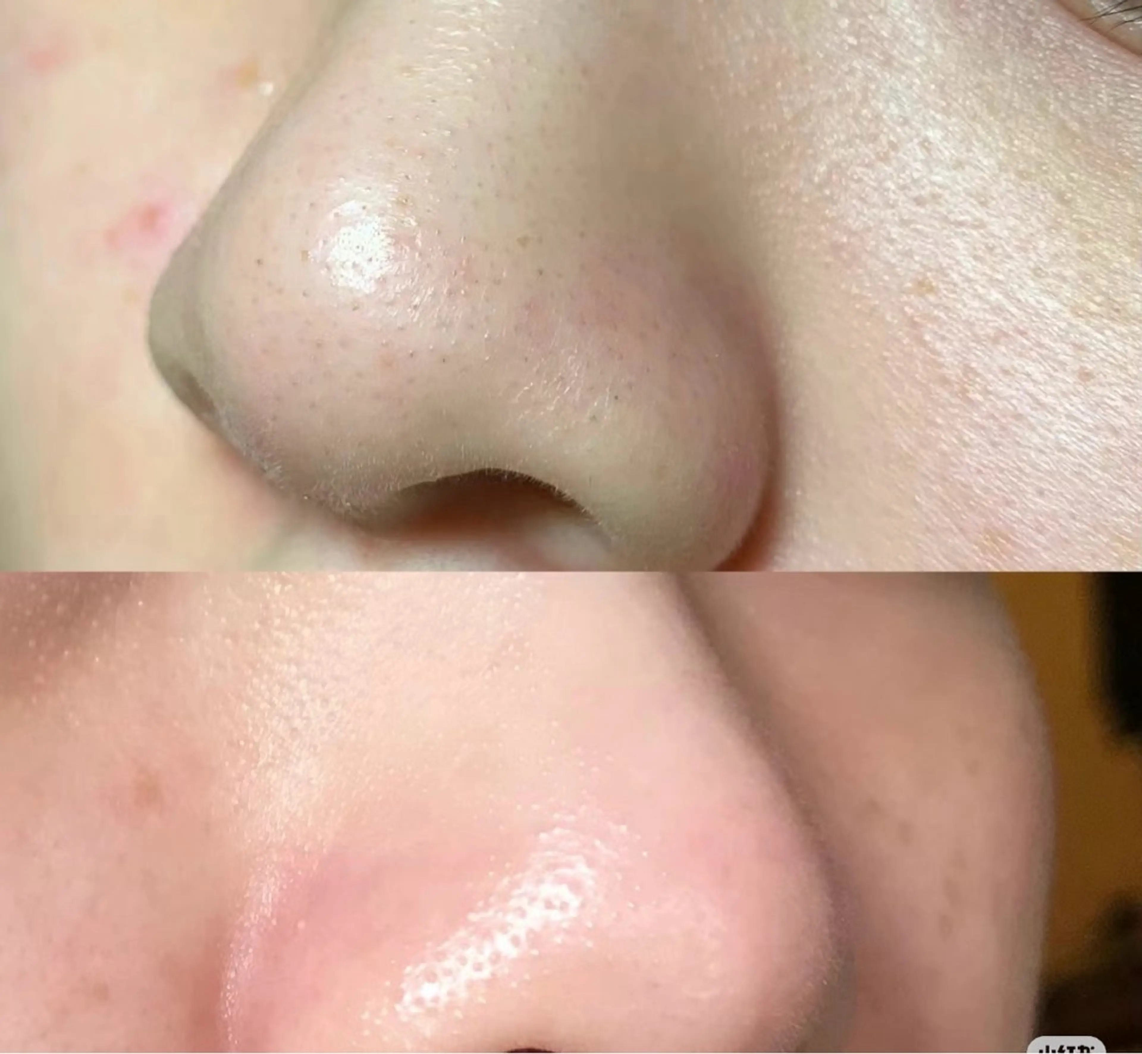 マツエク・マツパ エステ リラク 愛維美水光美肌専門店所属・愛維美水光美肌専門店 メンズレディースokのエステ・リラクイメージ