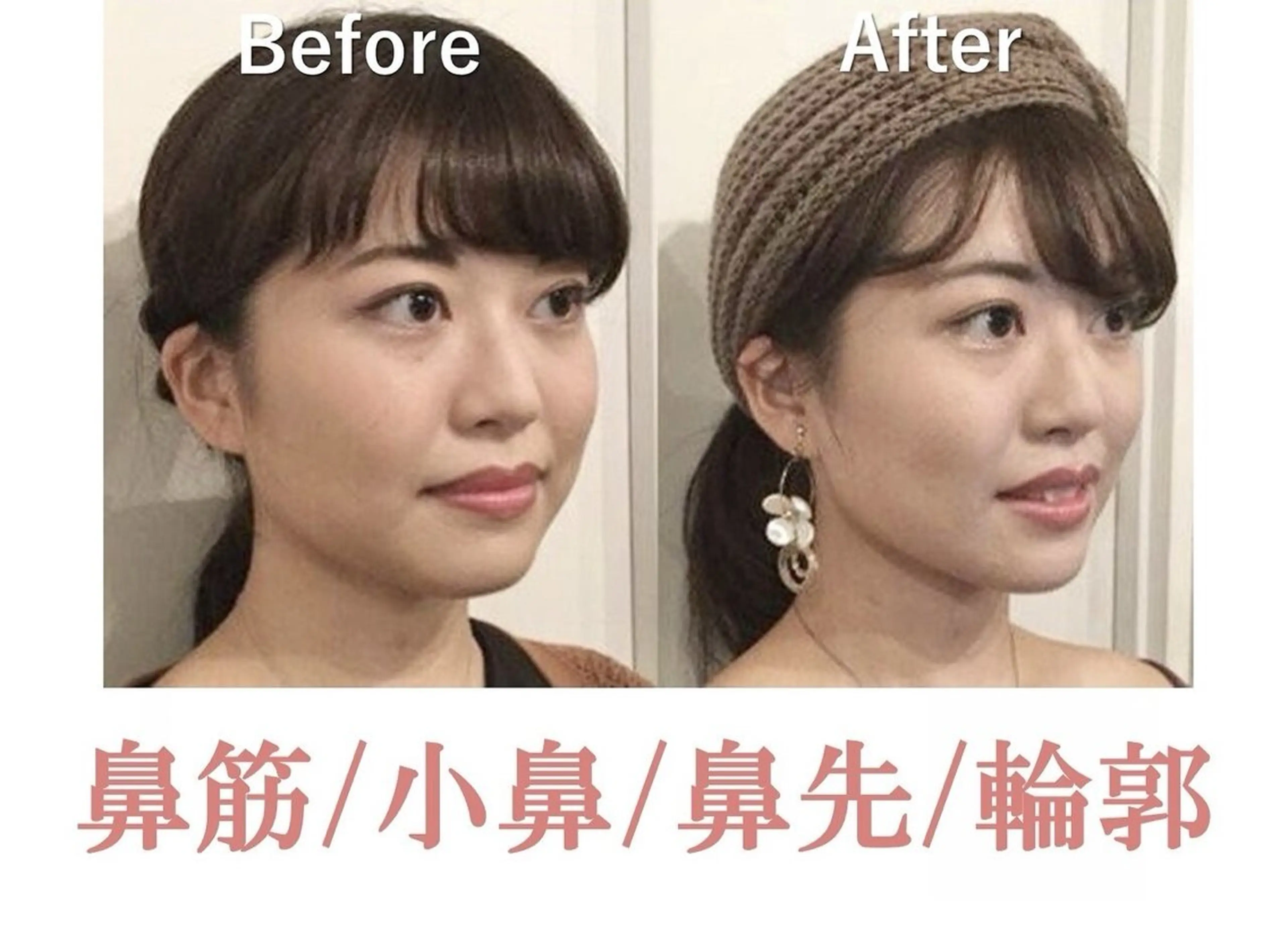 美鼻&小顔専門店 ラプリ　毛井のエステ・リラクイメージ