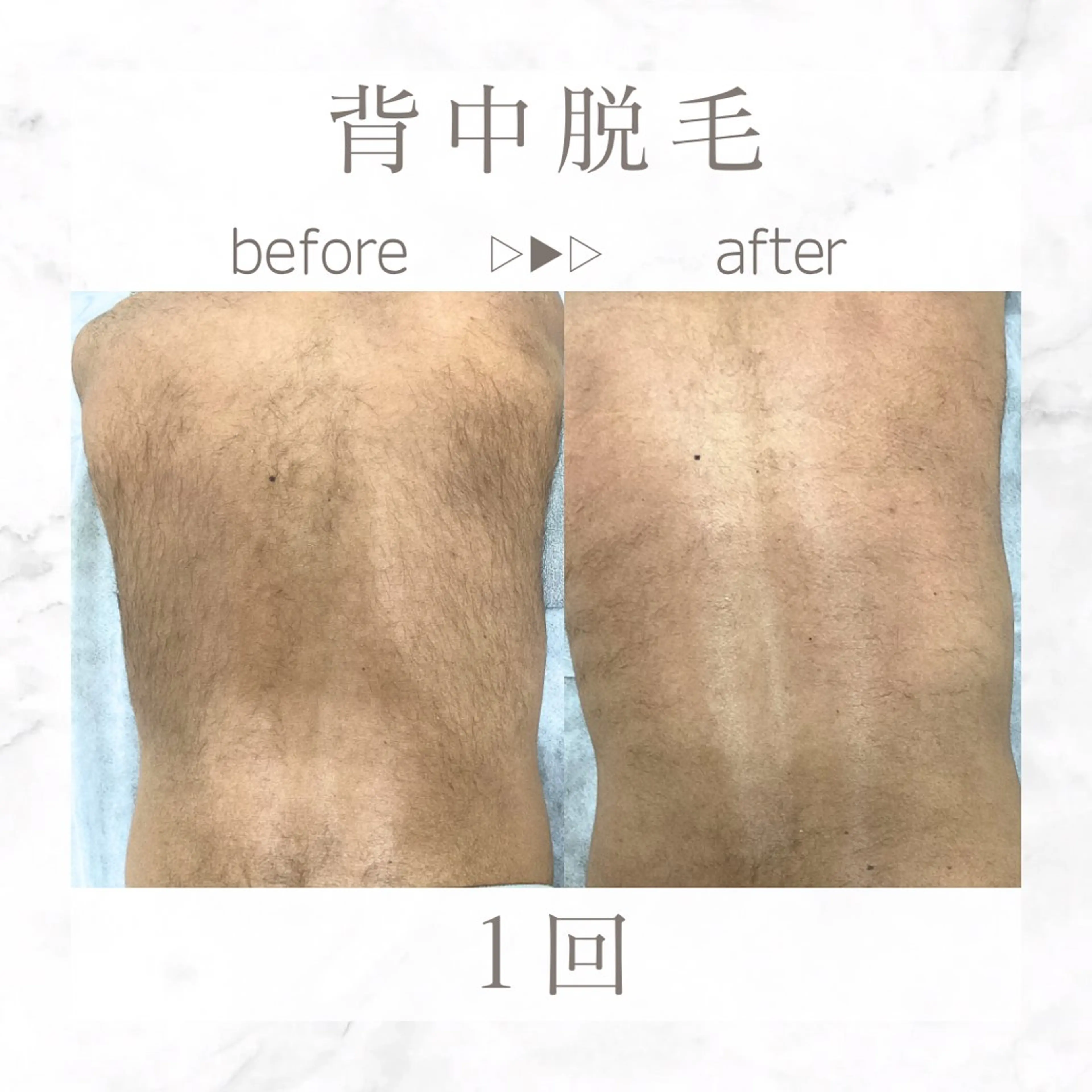 メンズ 脱毛 エステサロンNarcis〜ナルシス〜所属・脱毛＆痩身エステ Narcisのエステ・リラクイメージ