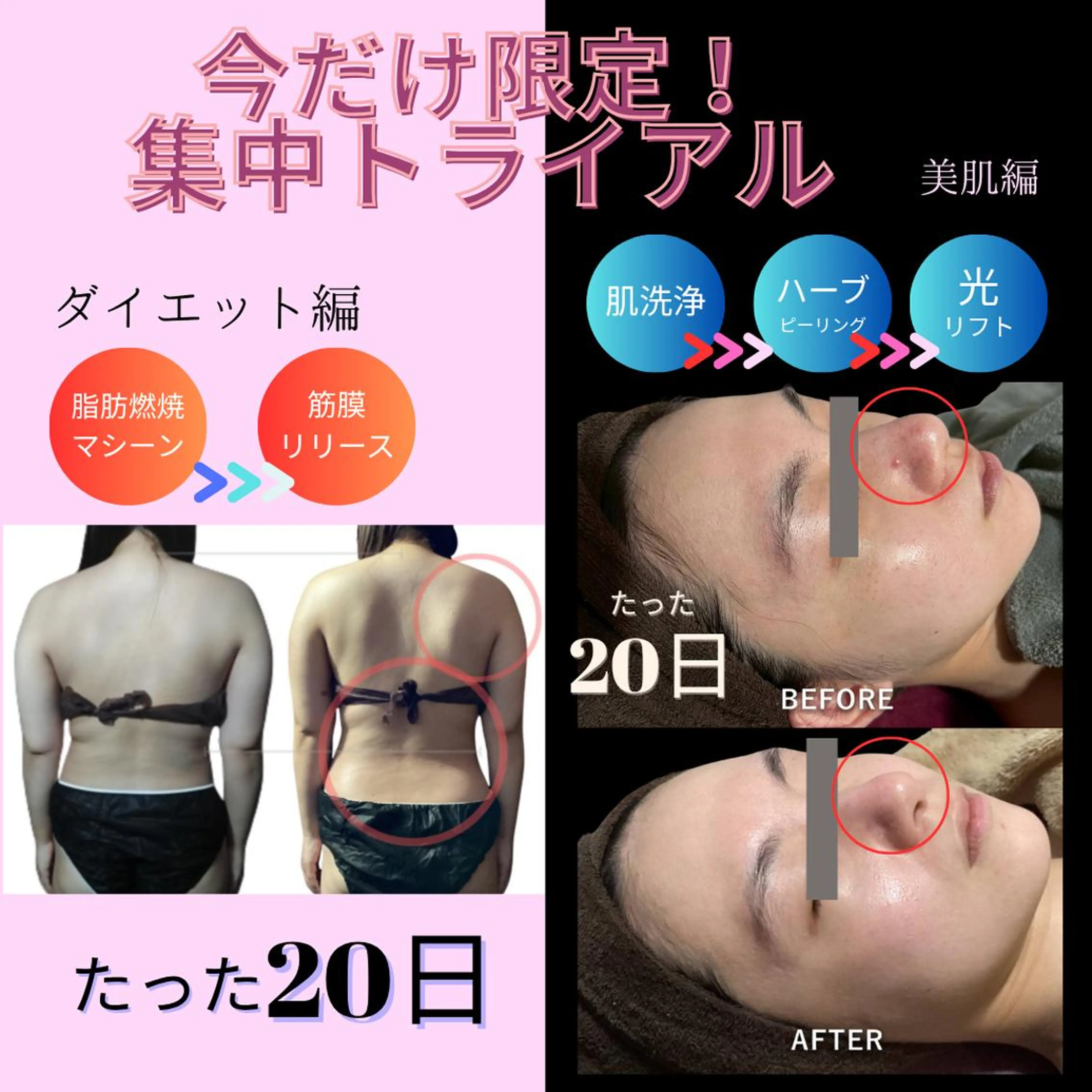 Adam 上半身美人のエステ・リラクイメージ